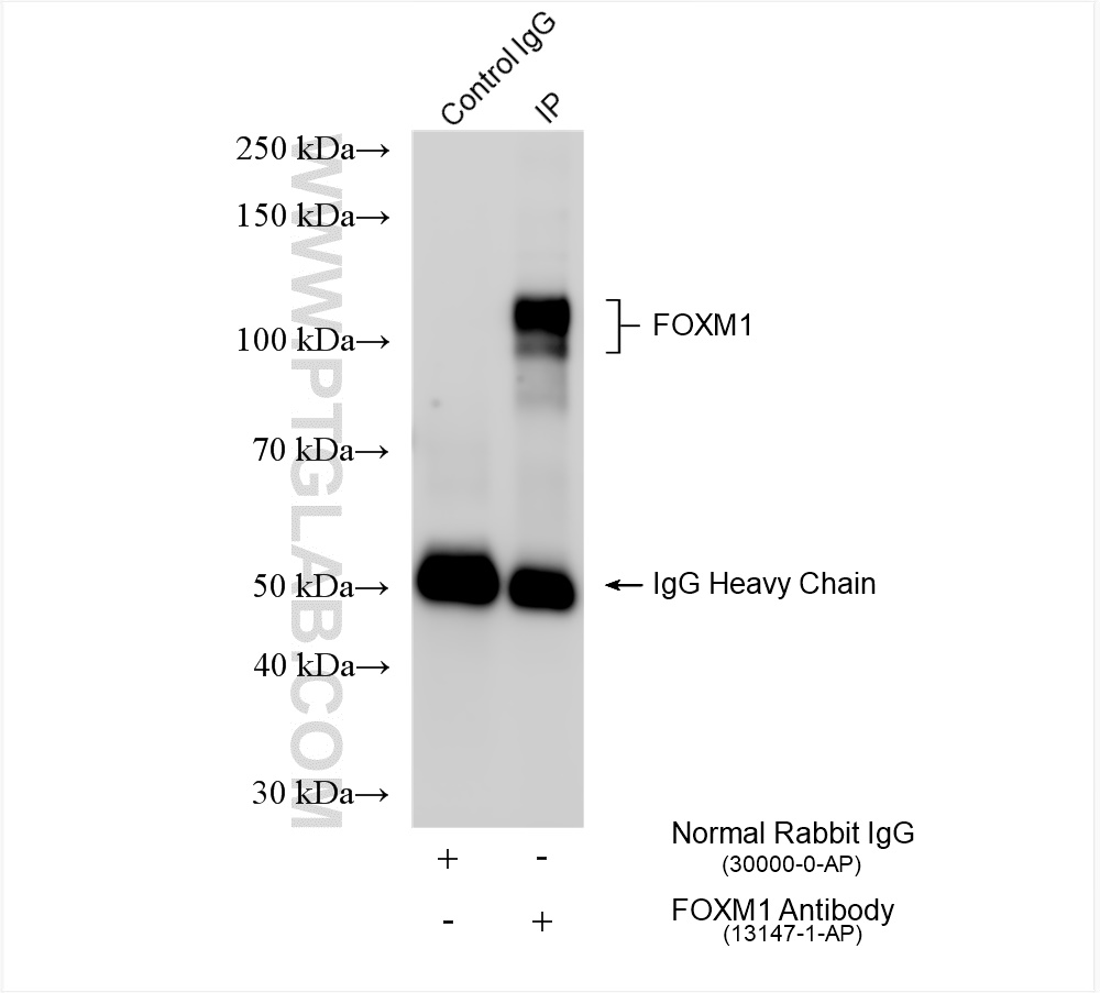 Immunoprecipitation (IP) experiment of L02 cells using FOXM1 Polyclonal antibody (13147-1-AP)