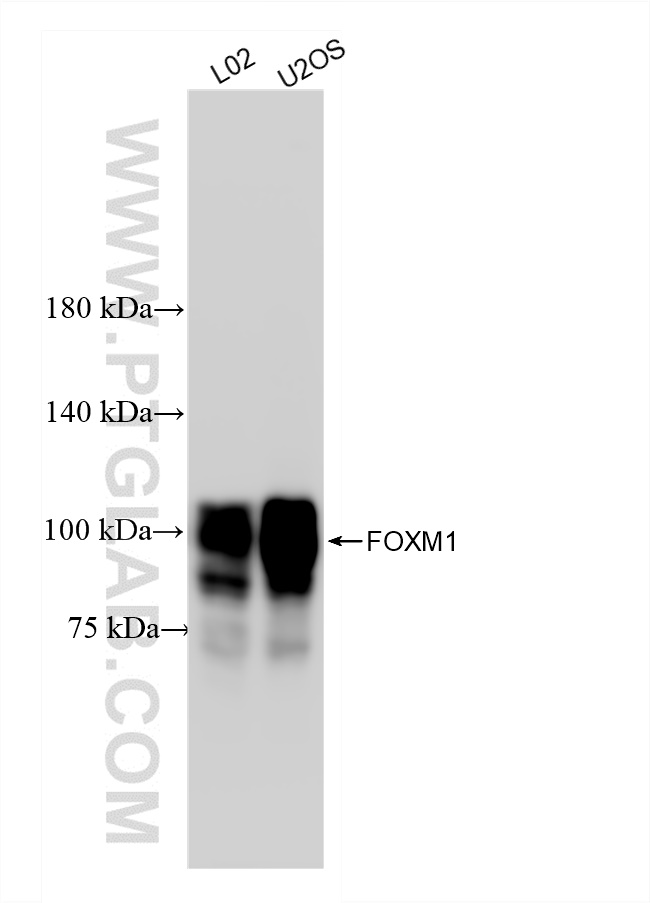 Western Blot (WB) analysis of various lysates using FOXM1 Recombinant antibody (84681-1-RR)