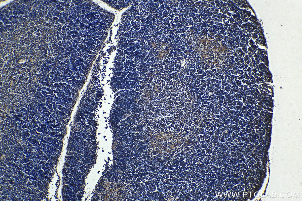 Immunohistochemistry (IHC) staining of mouse thymus tissue using FOXN1 Monoclonal antibody (66337-1-Ig)