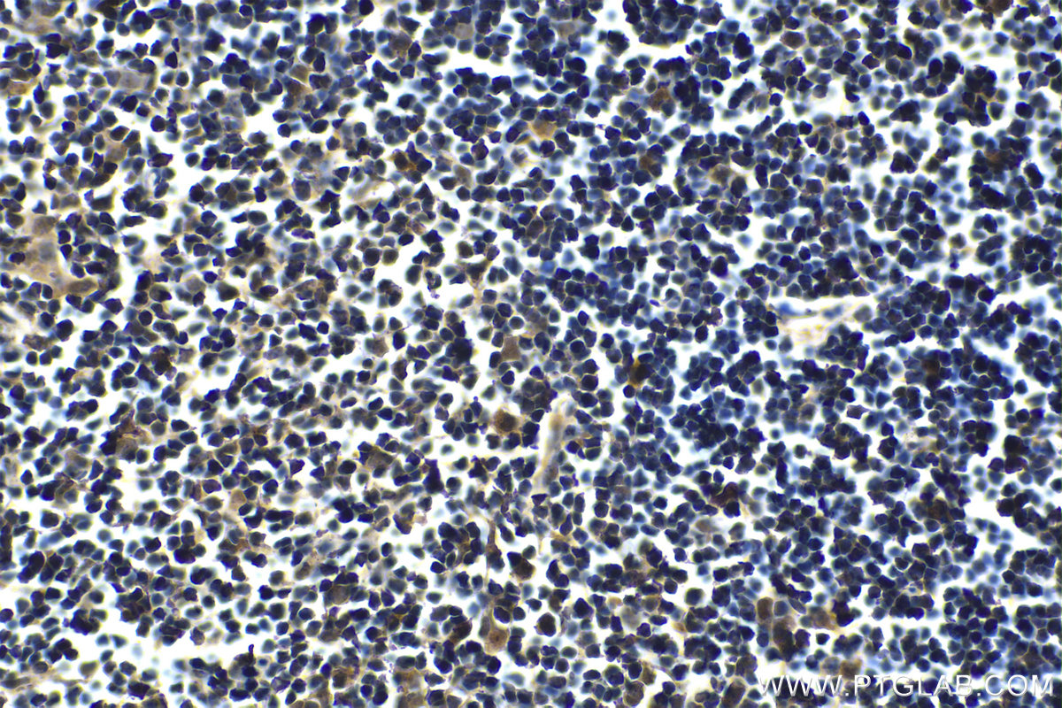 Immunohistochemistry (IHC) staining of mouse thymus tissue using FOXN1 Monoclonal antibody (66337-1-Ig)