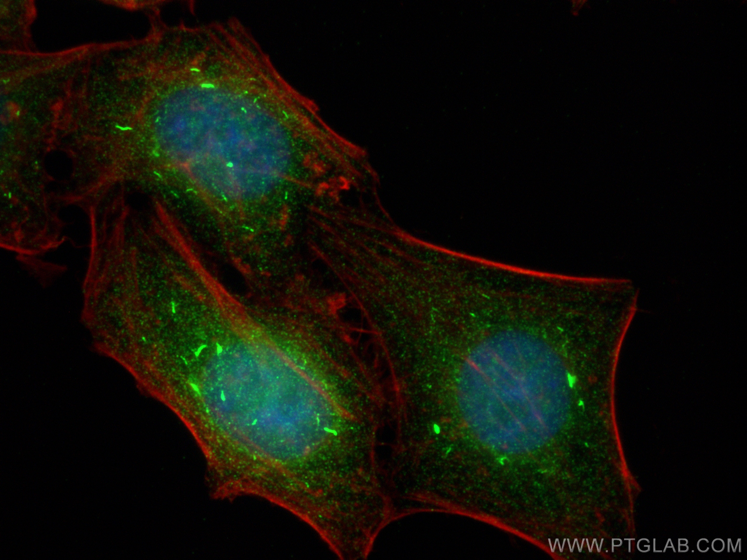 Immunofluorescence (IF) / fluorescent staining of HepG2 cells using FOXO1 Recombinant antibody (82997-1-RR)