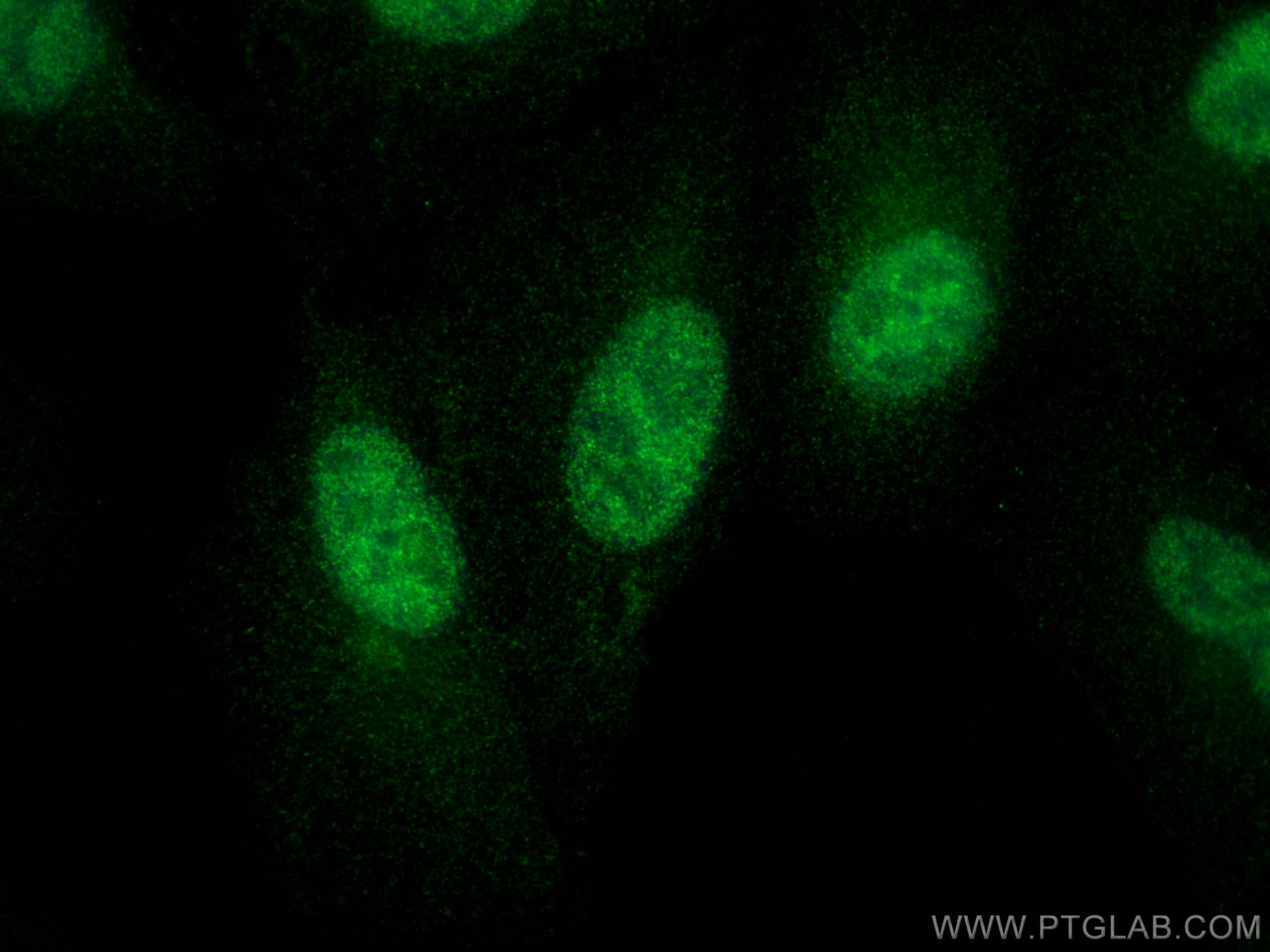 Immunofluorescence (IF) / fluorescent staining of A549 cells using FOXO6 Polyclonal antibody (19122-1-AP)