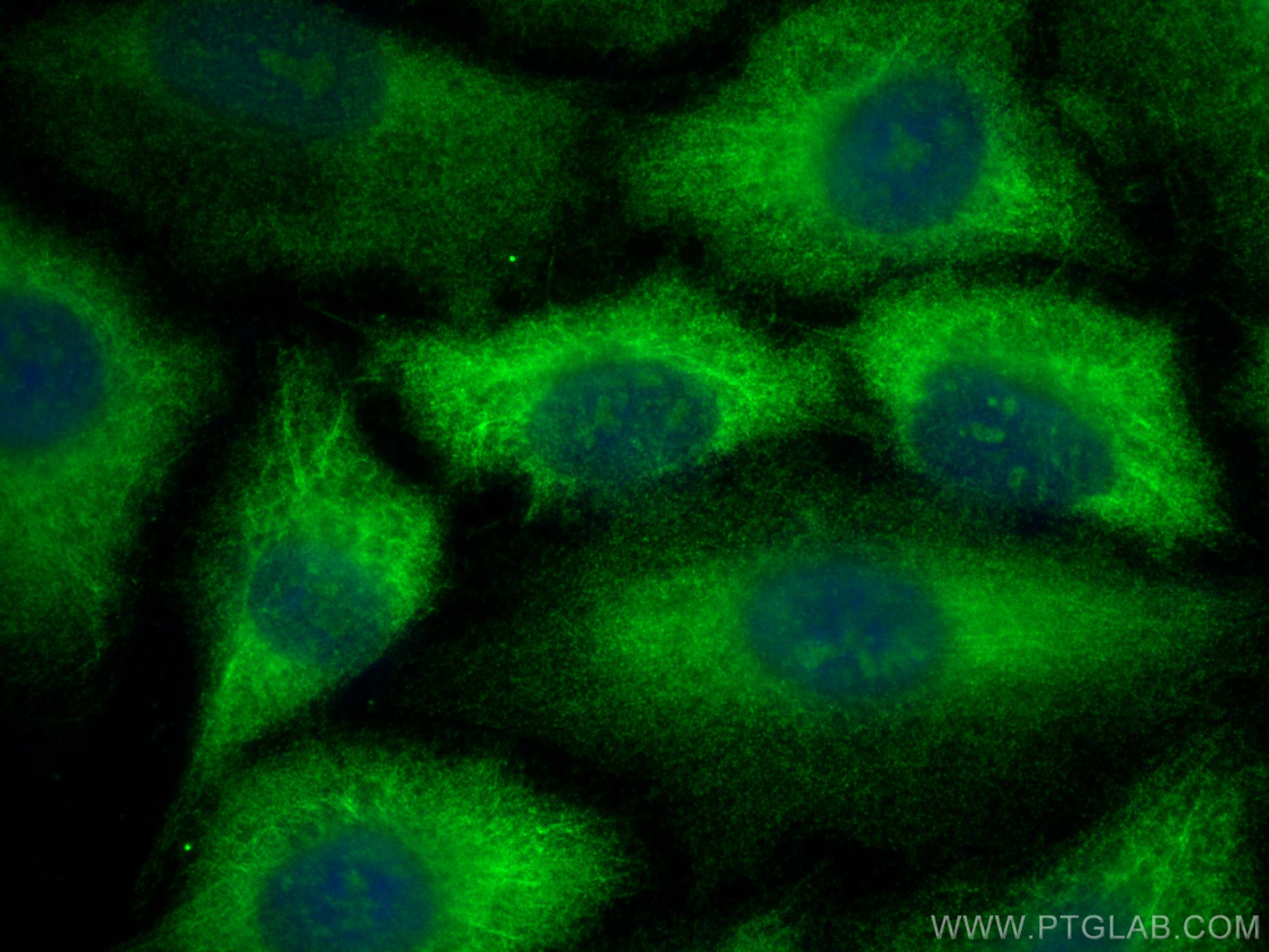 Immunofluorescence (IF) / fluorescent staining of A549 cells using FOXO6 Polyclonal antibody (19122-1-AP)