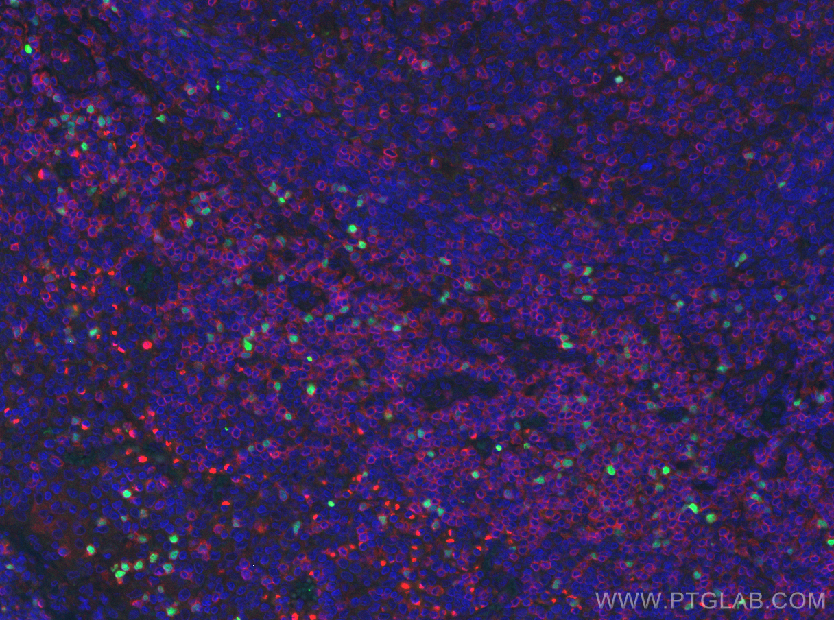 Immunofluorescence (IF) / fluorescent staining of human tonsillitis tissue using FOXP3 Polyclonal antibody (22228-1-AP)