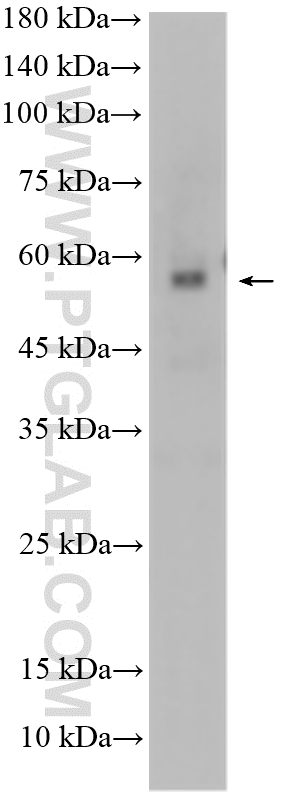 Western Blot (WB) analysis of A375 cells using FOXP3 Polyclonal antibody (22228-1-AP)