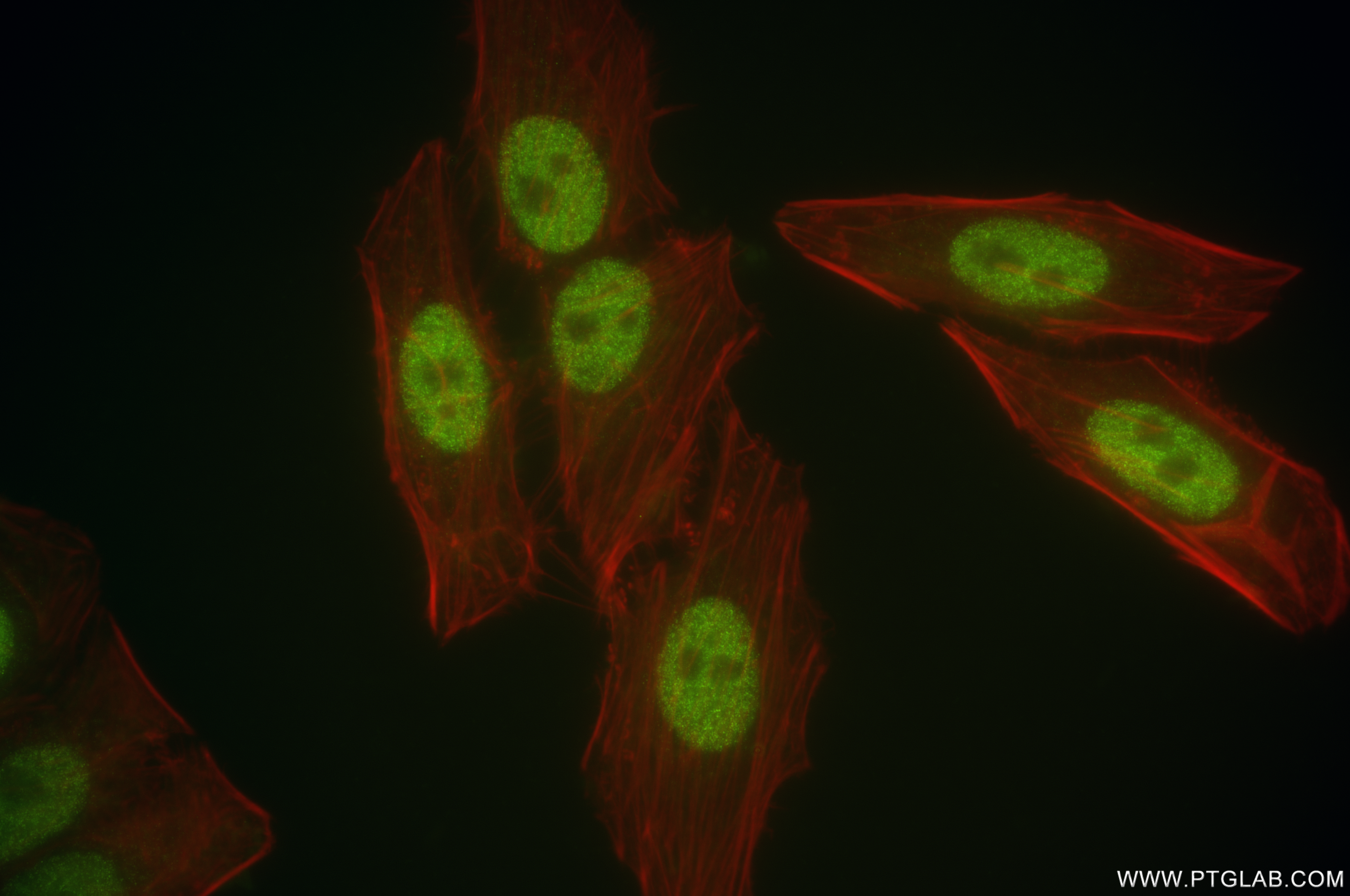 Immunofluorescence (IF) / fluorescent staining of HepG2 cells using FOXP4 Recombinant antibody (84855-1-RR)