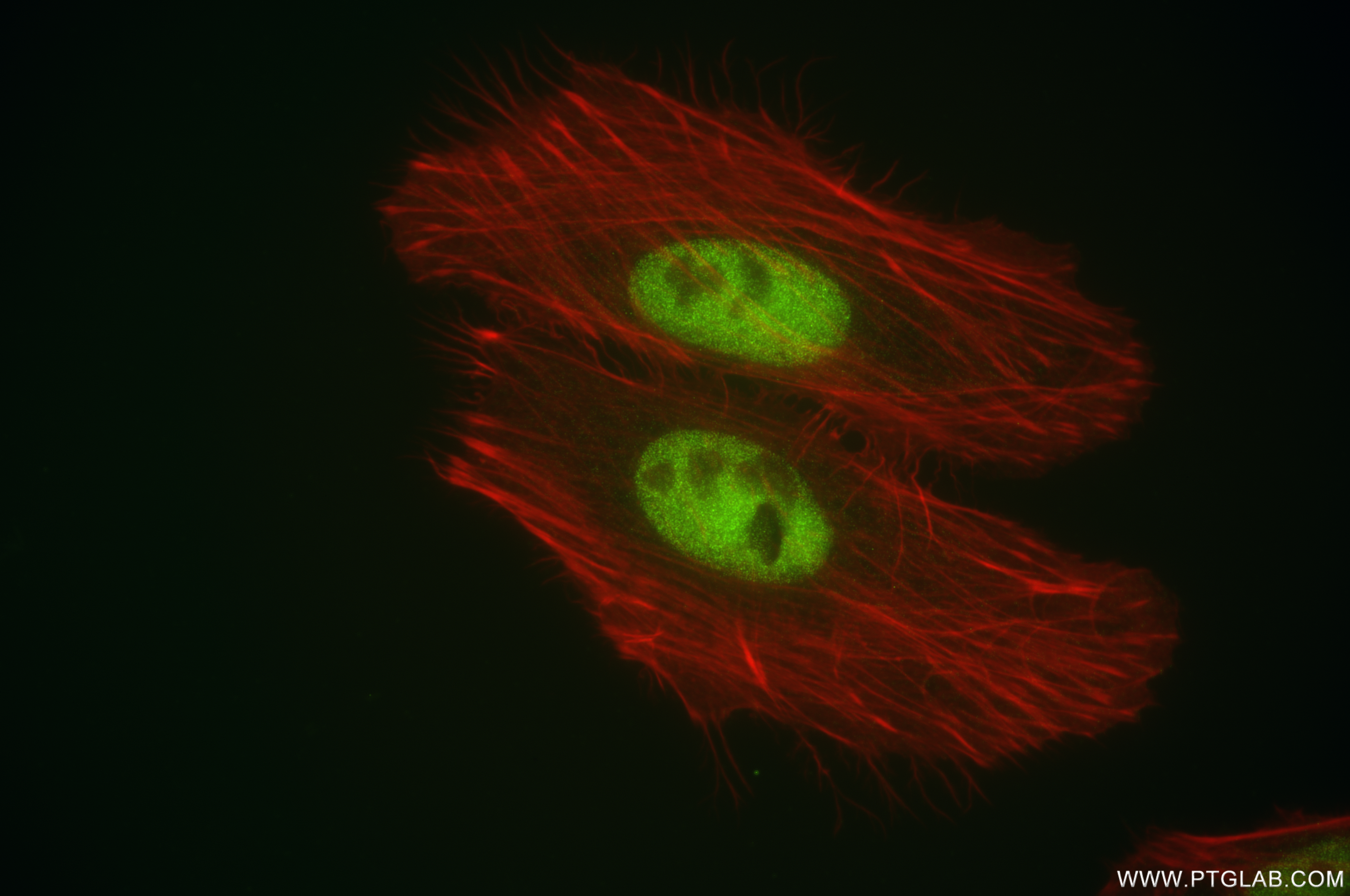 Immunofluorescence (IF) / fluorescent staining of HeLa cells using FOXP4 Recombinant antibody (84855-1-RR)