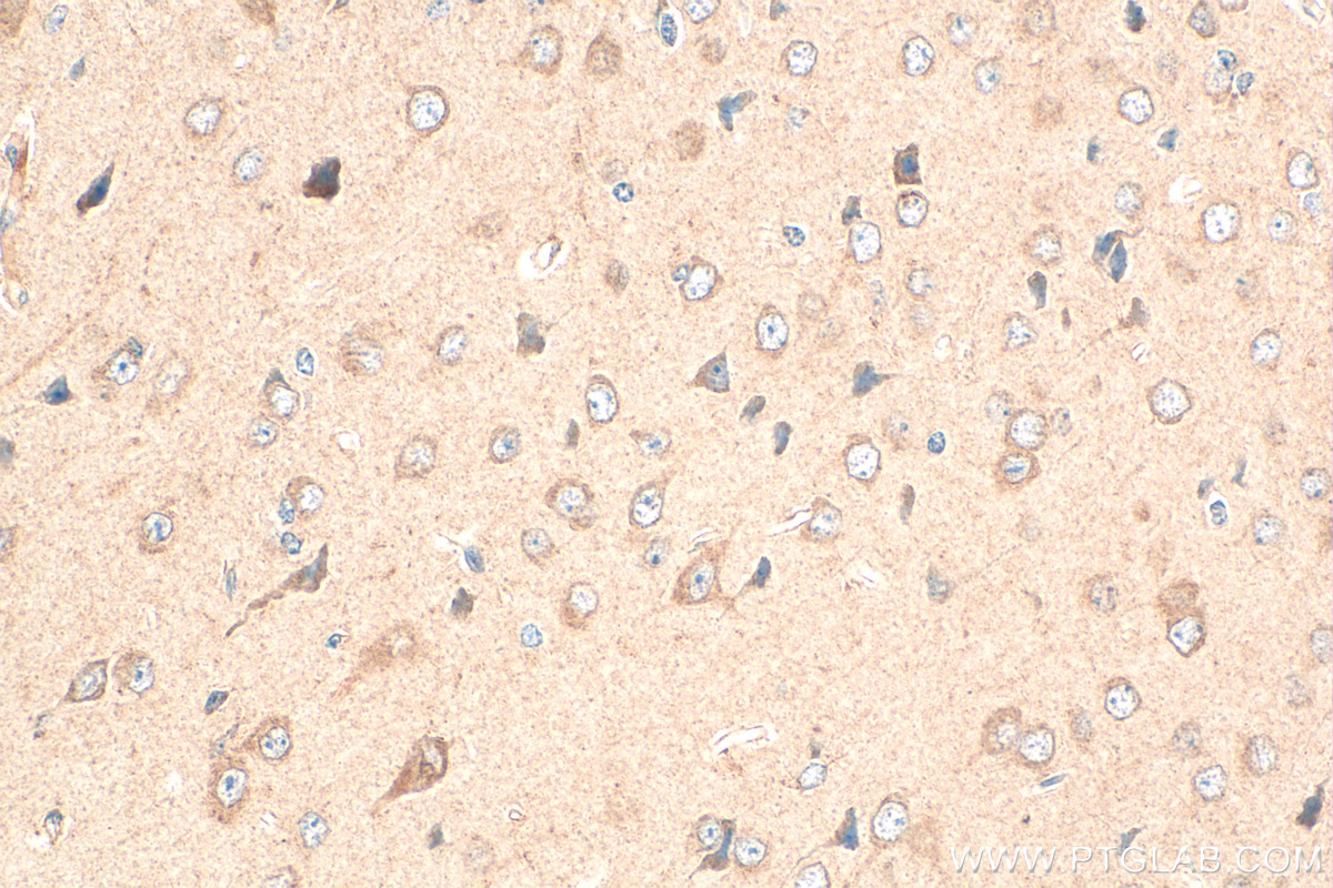 Immunohistochemistry (IHC) staining of mouse brain tissue using FPR2 Polyclonal antibody (30989-1-AP)