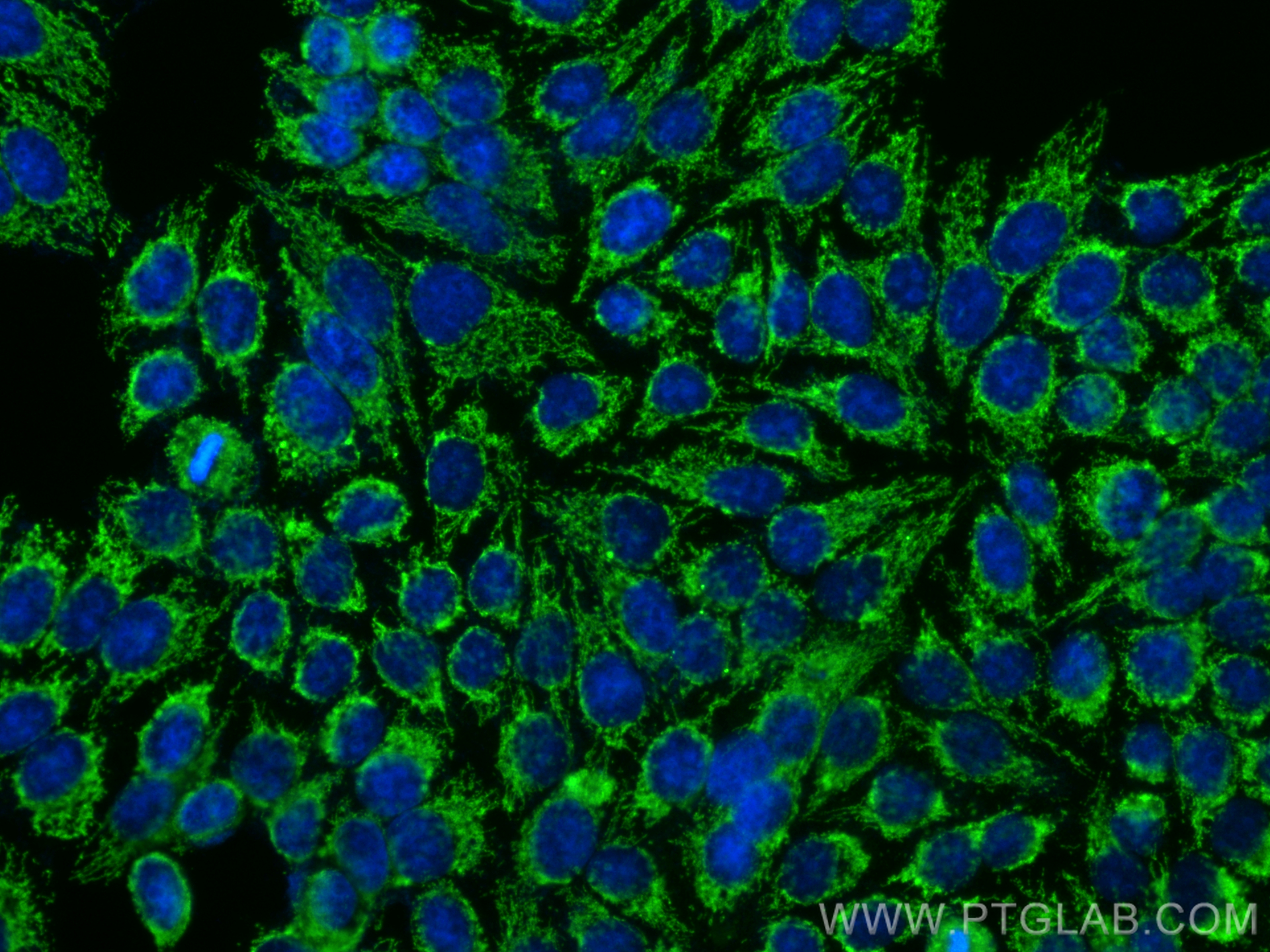 Immunofluorescence (IF) / fluorescent staining of HepG2 cells using FREM1 Polyclonal antibody (13086-1-AP)