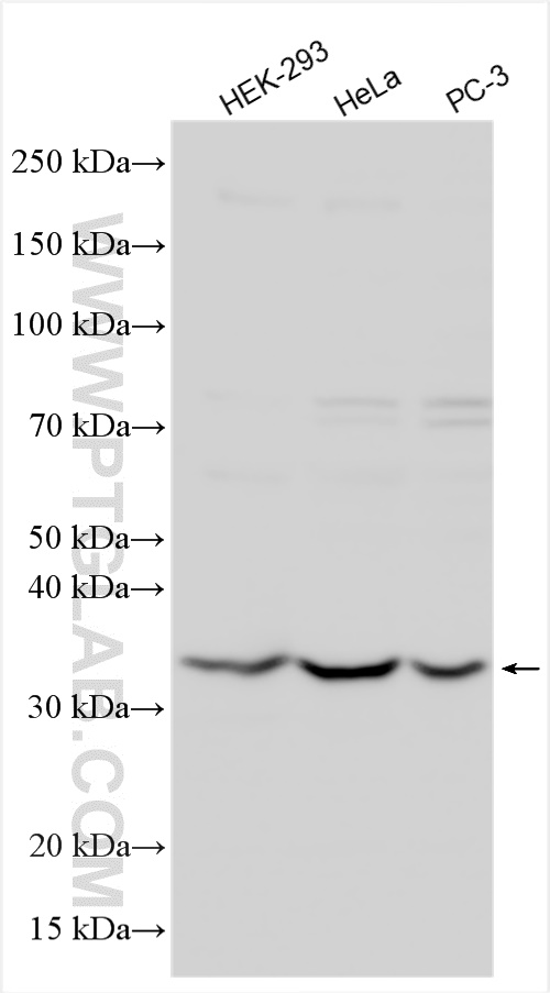 Western Blot (WB) analysis of various lysates using FRG1 Polyclonal antibody (14607-1-AP)