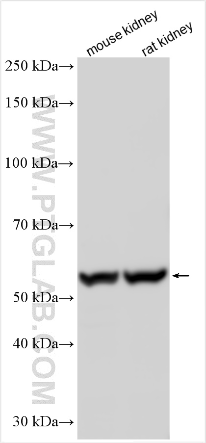 Western Blot (WB) analysis of various lysates using FRK Polyclonal antibody (16197-1-AP)