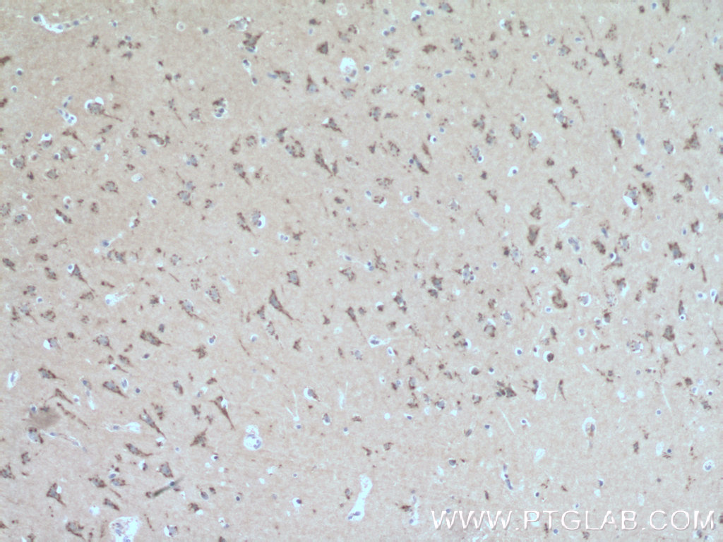 Immunohistochemistry (IHC) staining of human brain tissue using FRMPD4 Polyclonal antibody (23943-1-AP)