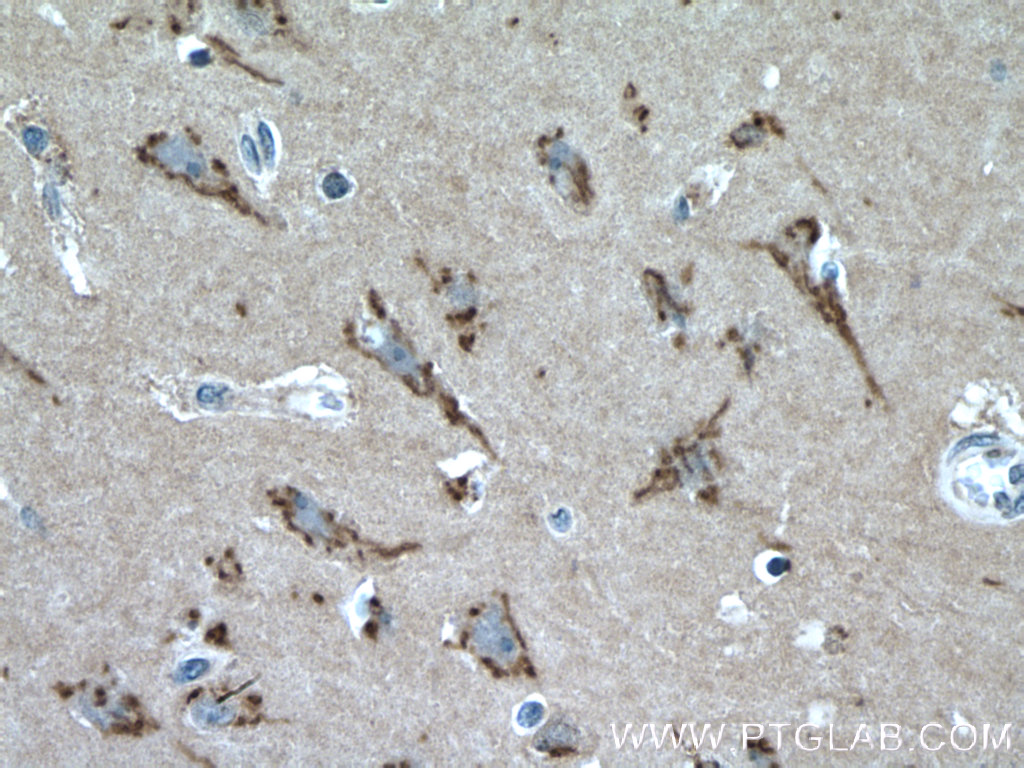 Immunohistochemistry (IHC) staining of human brain tissue using FRMPD4 Polyclonal antibody (23943-1-AP)