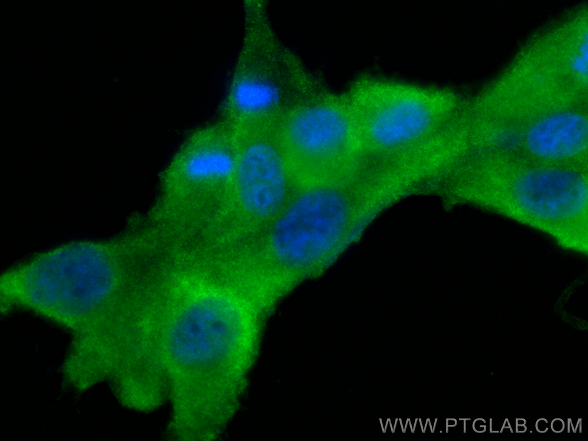 Immunofluorescence (IF) / fluorescent staining of U-87 MG cells using Fascin Polyclonal antibody (14384-1-AP)