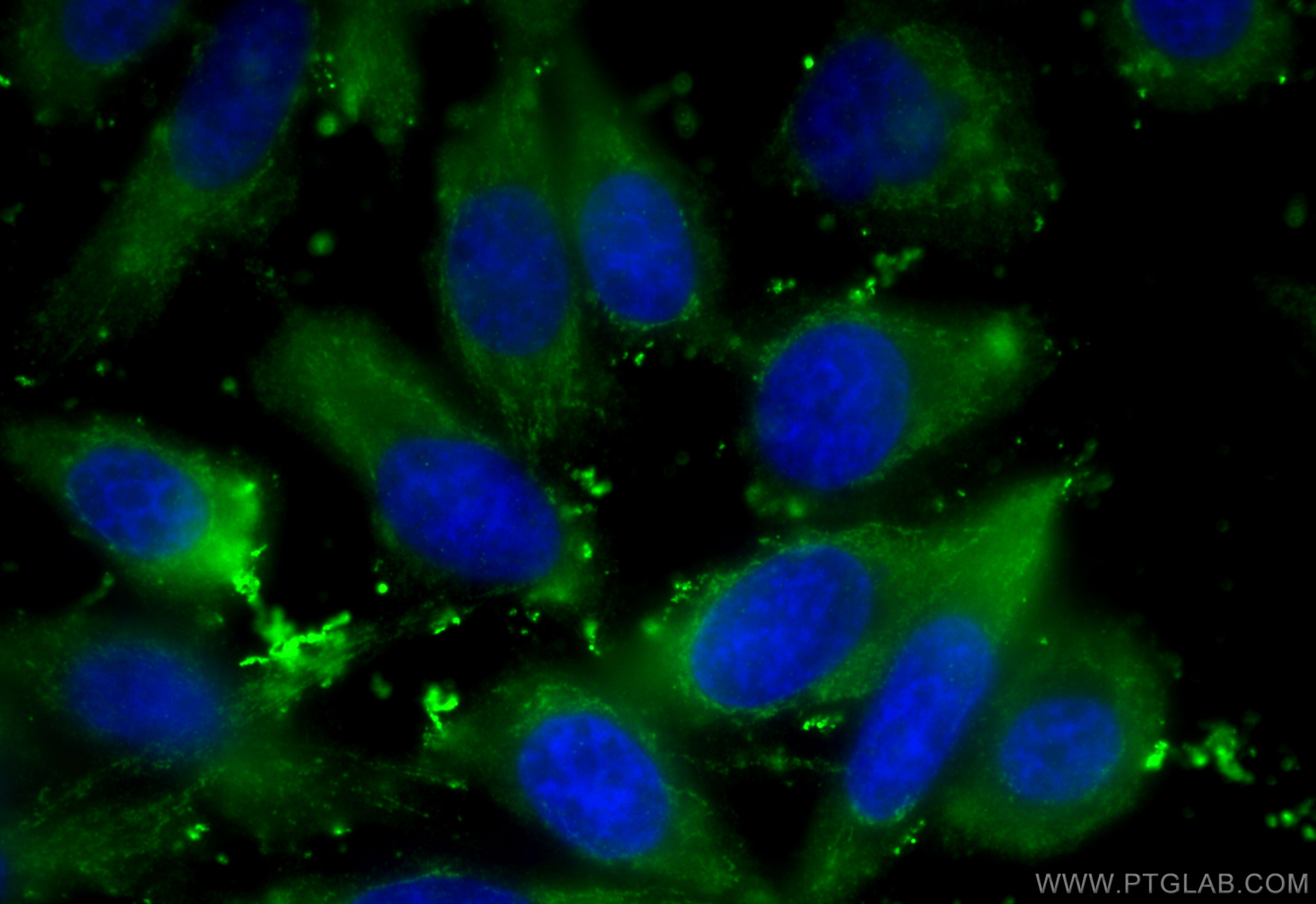 Immunofluorescence (IF) / fluorescent staining of PC-3 cells using FSCN3 Polyclonal antibody (13536-1-AP)