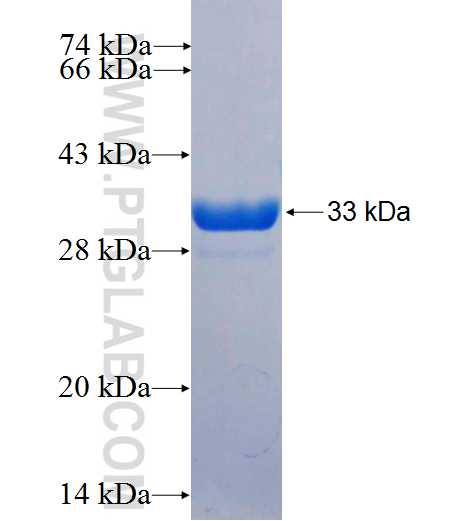 FSD1 fusion protein Ag26566 SDS-PAGE