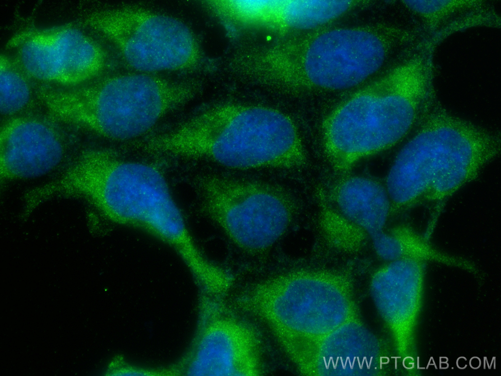 Immunofluorescence (IF) / fluorescent staining of HEK-293 cells using FSD1L Polyclonal antibody (21032-1-AP)