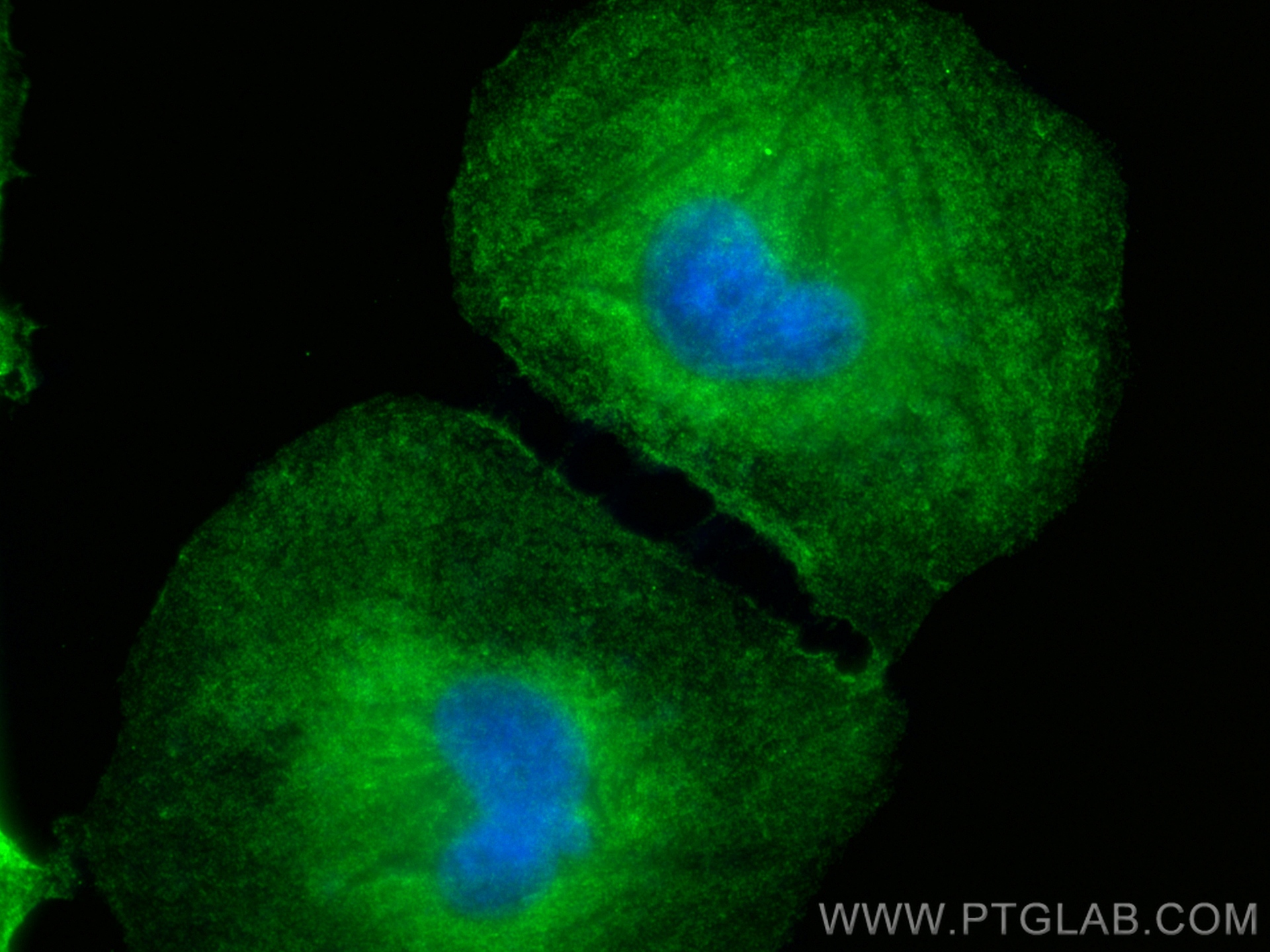 Immunofluorescence (IF) / fluorescent staining of HeLa cells using FSD1L Polyclonal antibody (21032-1-AP)