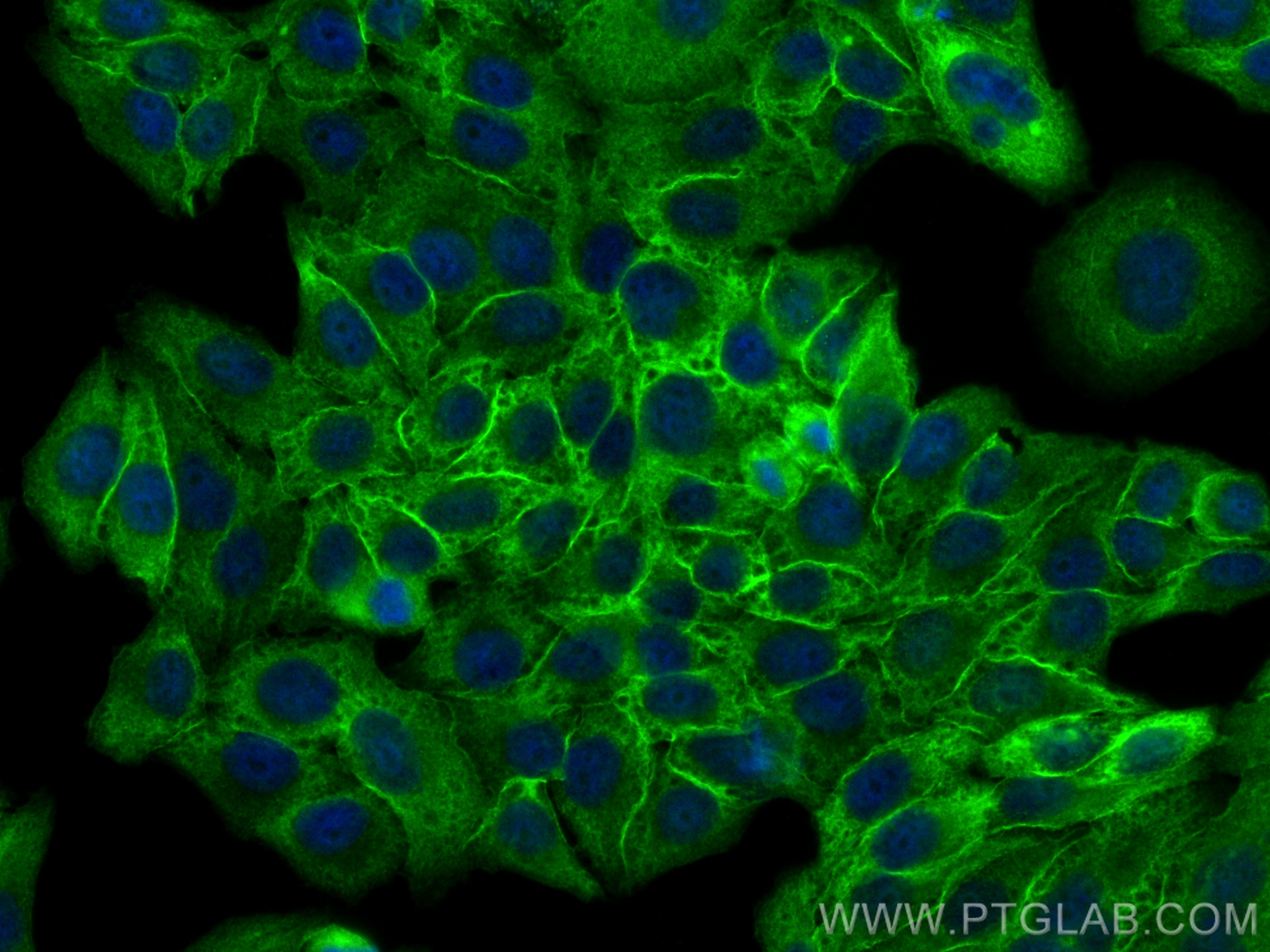 Immunofluorescence (IF) / fluorescent staining of HepG2 cells using FSD1L Polyclonal antibody (21032-1-AP)