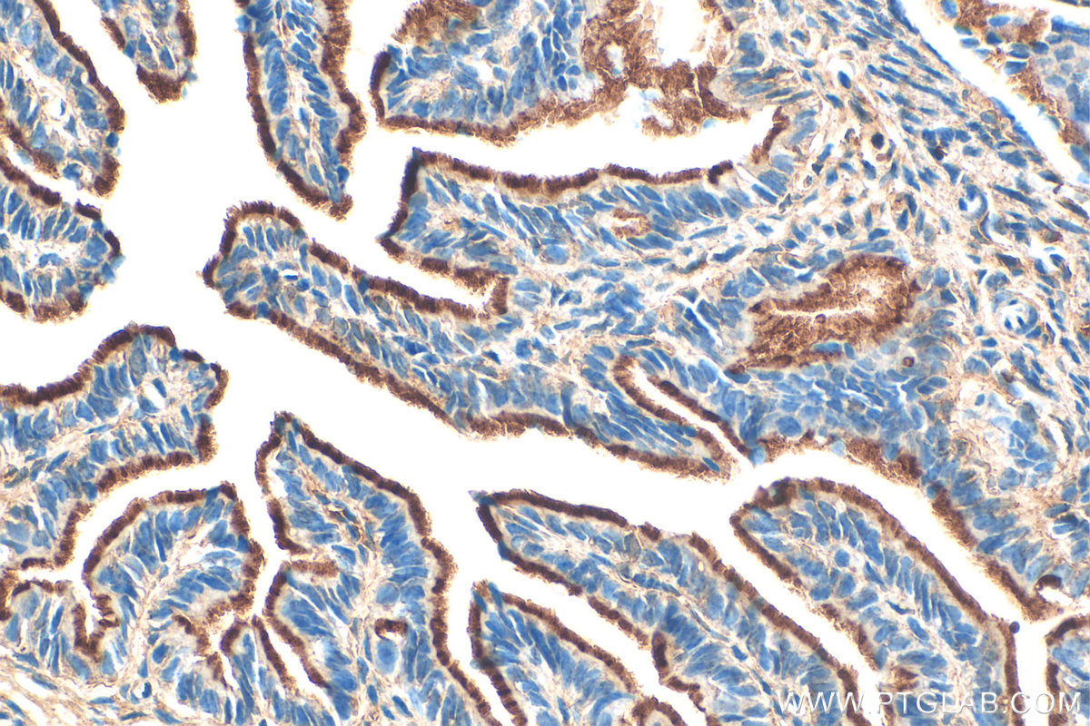 Immunohistochemistry (IHC) staining of mouse ovary tissue using FSHR Polyclonal antibody (22665-1-AP)