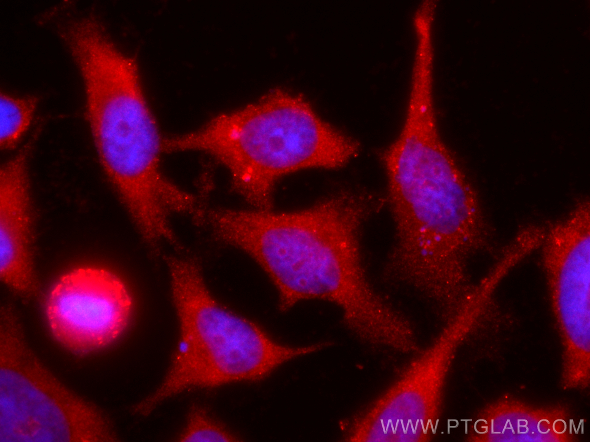 Immunofluorescence (IF) / fluorescent staining of HeLa cells using CoraLite®594-conjugated FSHR Polyclonal antibody (CL594-22665)