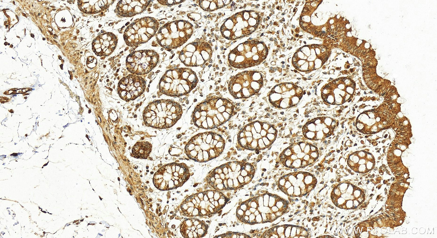 Immunohistochemistry (IHC) staining of human colon tissue using FSTL1 Polyclonal antibody (20182-1-AP)