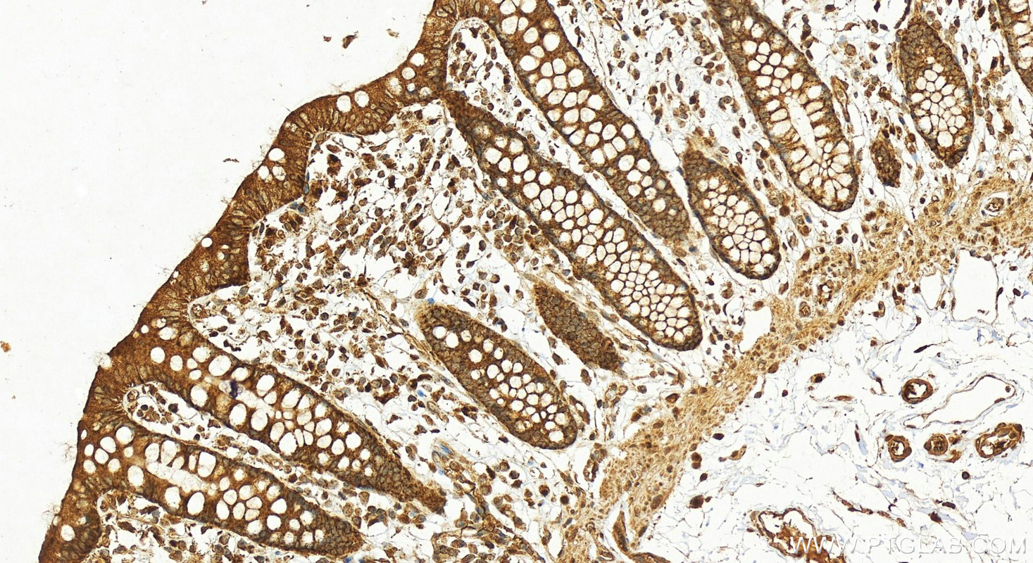 Immunohistochemistry (IHC) staining of human colon tissue using FSTL1 Polyclonal antibody (20182-1-AP)