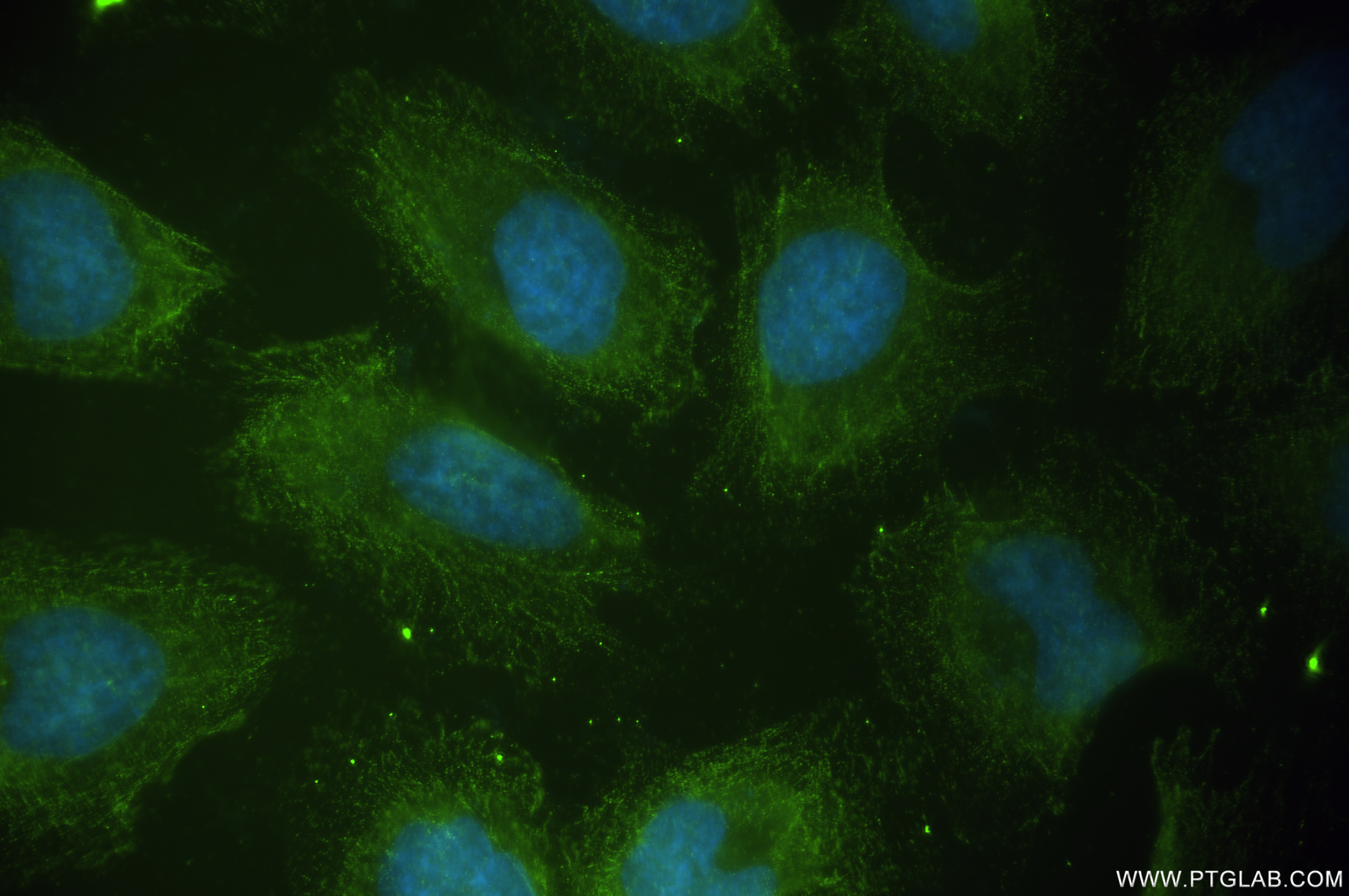 Immunofluorescence (IF) / fluorescent staining of HeLa cells using FSTL1 Recombinant antibody (84672-2-RR)