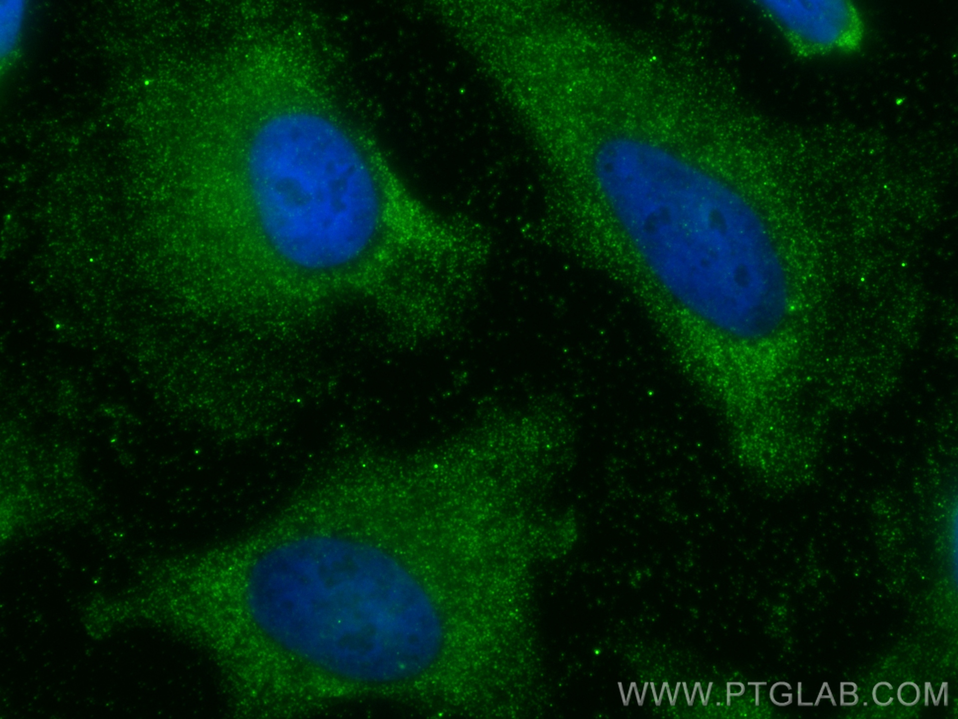 Immunofluorescence (IF) / fluorescent staining of HeLa cells using Ferritin heavy chain Monoclonal antibody (60875-5-Ig)
