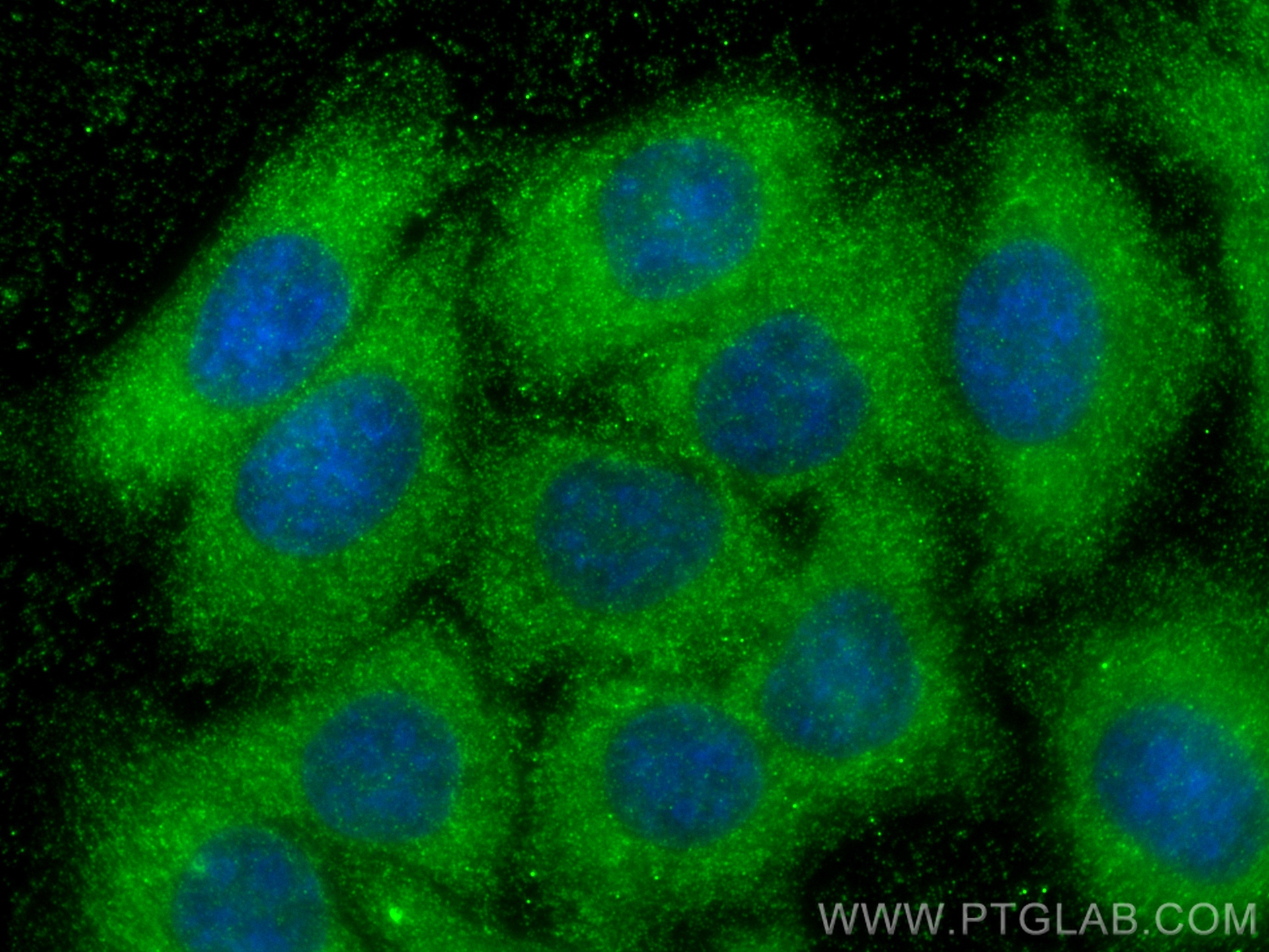 Immunofluorescence (IF) / fluorescent staining of HepG2 cells using Ferritin heavy chain Monoclonal antibody (60875-5-Ig)