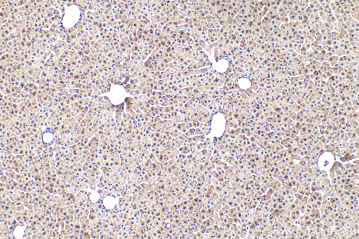 Immunohistochemistry (IHC) staining of rat liver tissue using Ferritin heavy chain Monoclonal antibody (60875-5-Ig)