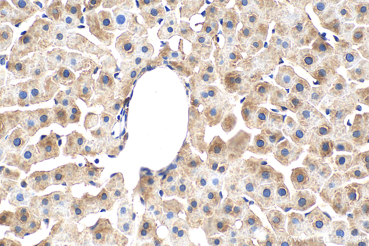 Immunohistochemistry (IHC) staining of rat liver tissue using Ferritin heavy chain Monoclonal antibody (60875-5-Ig)