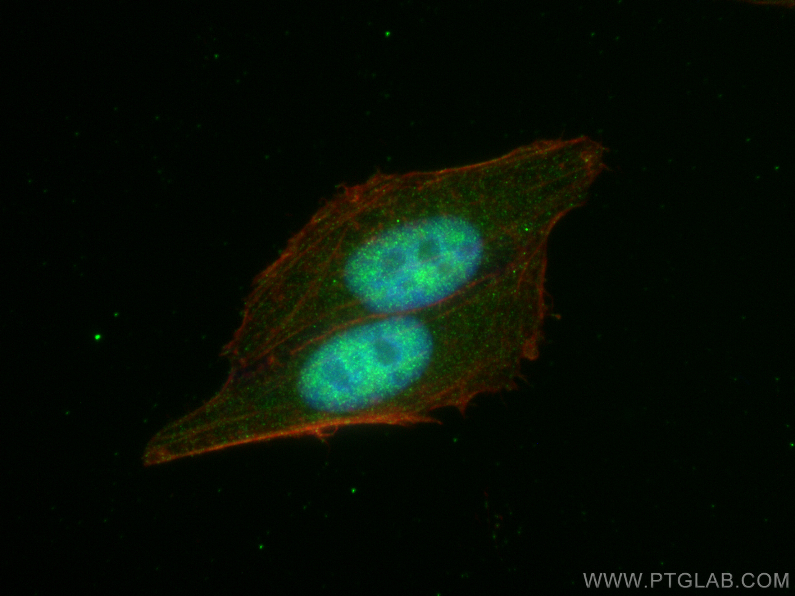 Immunofluorescence (IF) / fluorescent staining of HepG2 cells using FTO Recombinant antibody (81471-1-RR)
