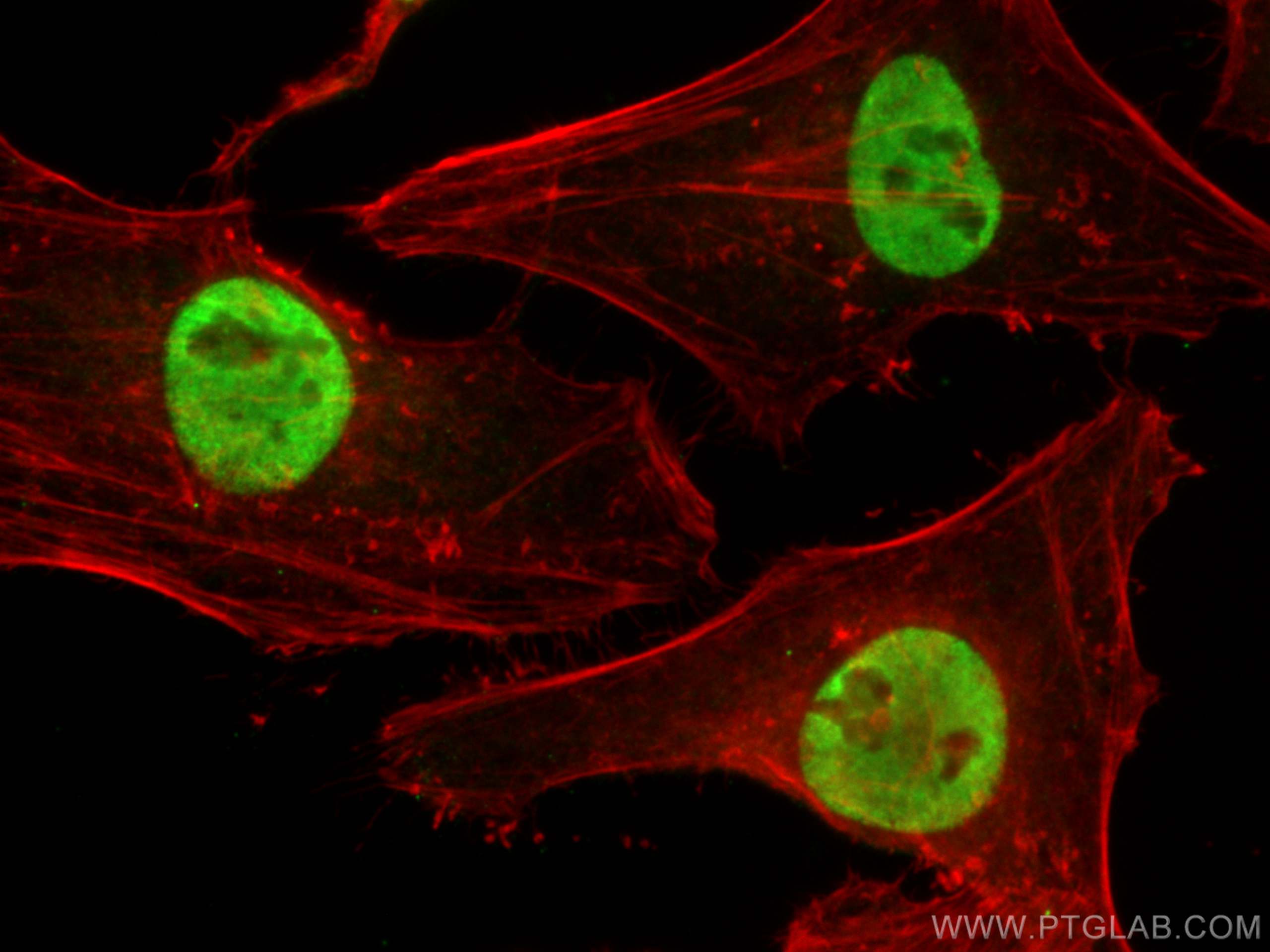 Immunofluorescence (IF) / fluorescent staining of HeLa cells using FUBP1 Polyclonal antibody (24864-1-AP)