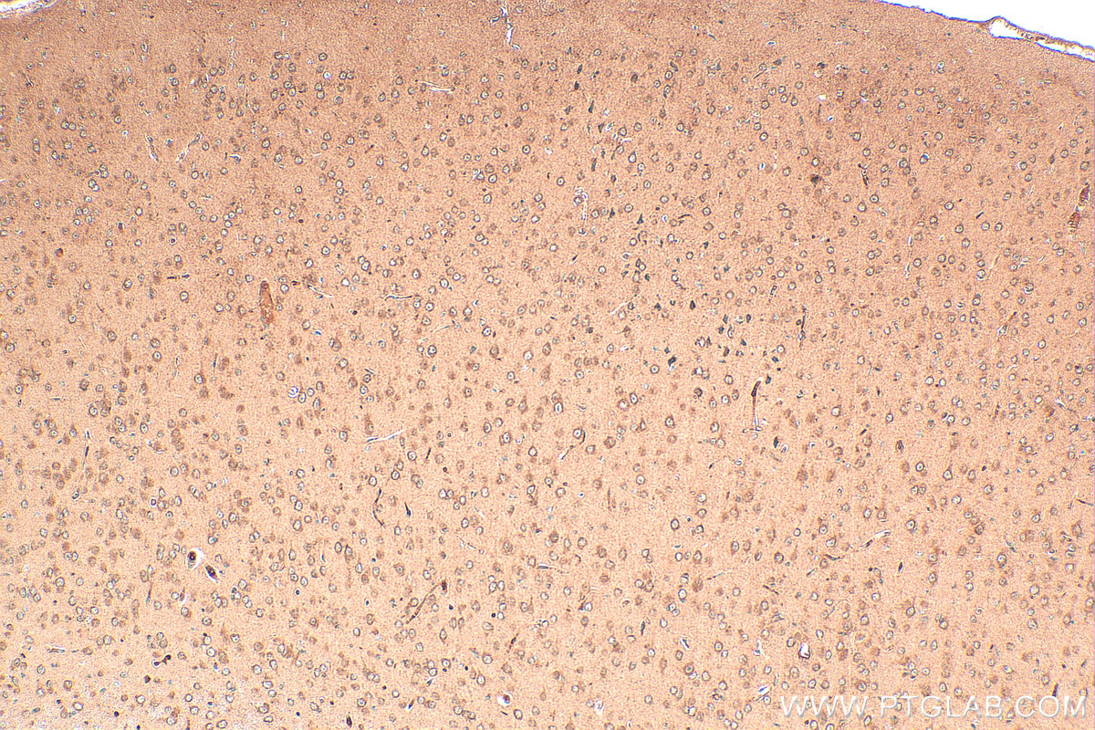 Immunohistochemistry (IHC) staining of mouse brain tissue using FUCA1 Polyclonal antibody (16420-1-AP)