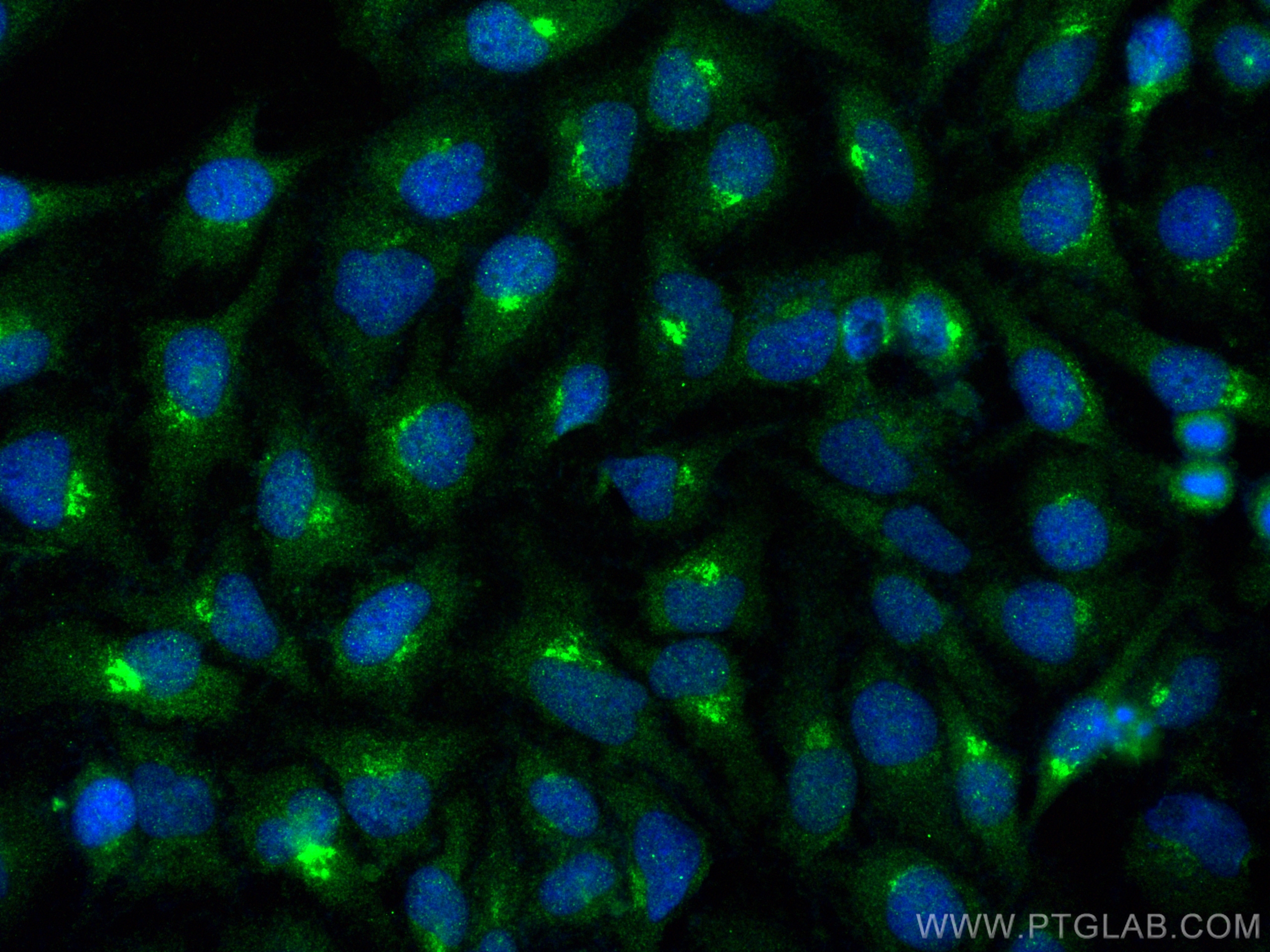 Immunofluorescence (IF) / fluorescent staining of HeLa cells using FURIN Polyclonal antibody (18413-1-AP)