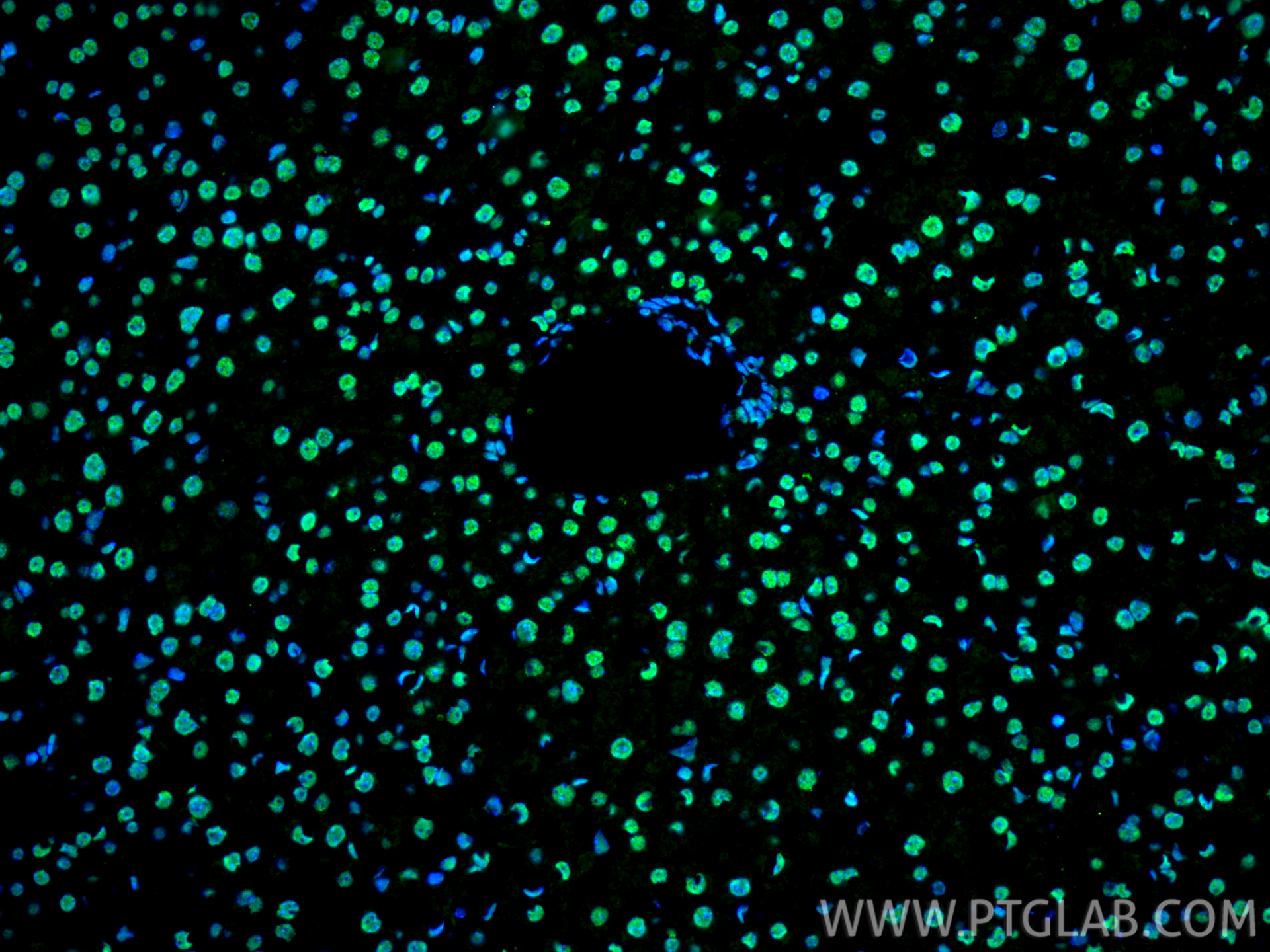 Immunofluorescence (IF) / fluorescent staining of mouse liver tissue using FUS/TLS Polyclonal antibody (11570-1-AP)