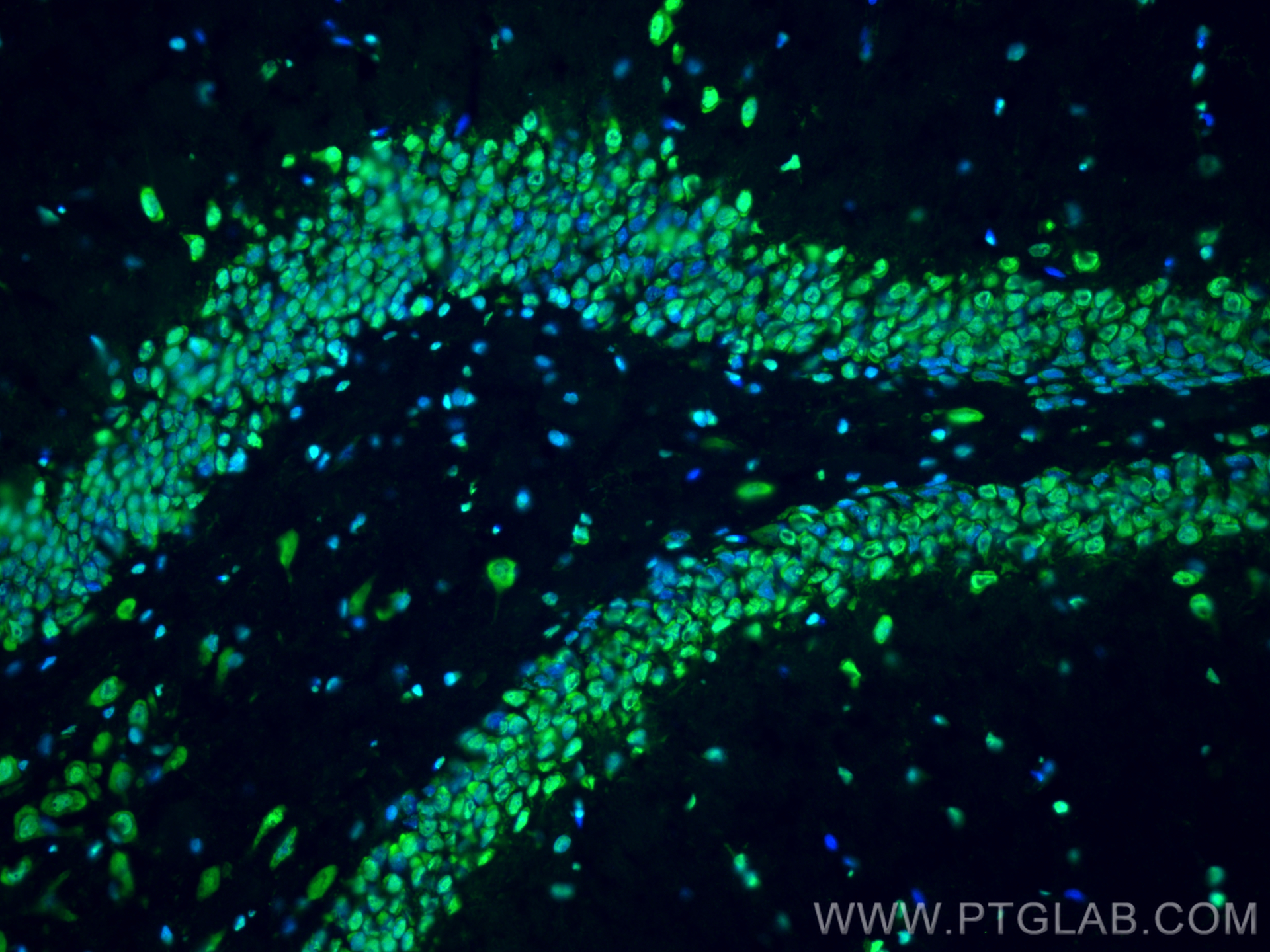 Immunofluorescence (IF) / fluorescent staining of rat brain tissue using FUS/TLS Monoclonal antibody (68262-1-Ig)