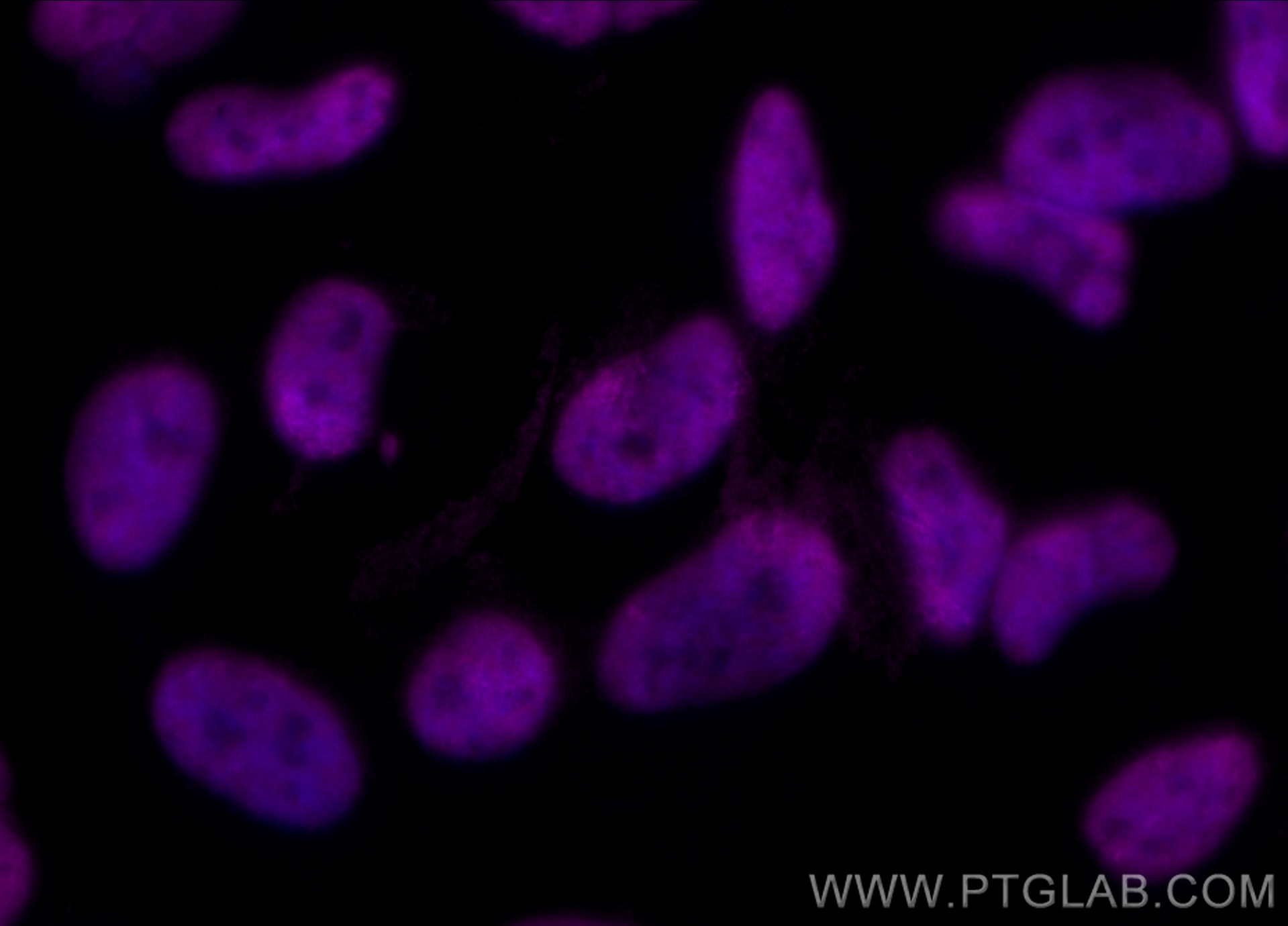 Immunofluorescence (IF) / fluorescent staining of HeLa cells using CoraLite® Plus 647-conjugated FUS/TLS Monoclonal a (CL647-60160)