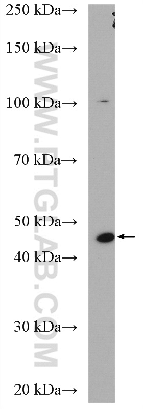 Western Blot (WB) analysis of A549 cells using FUT7 Polyclonal antibody (18197-1-AP)