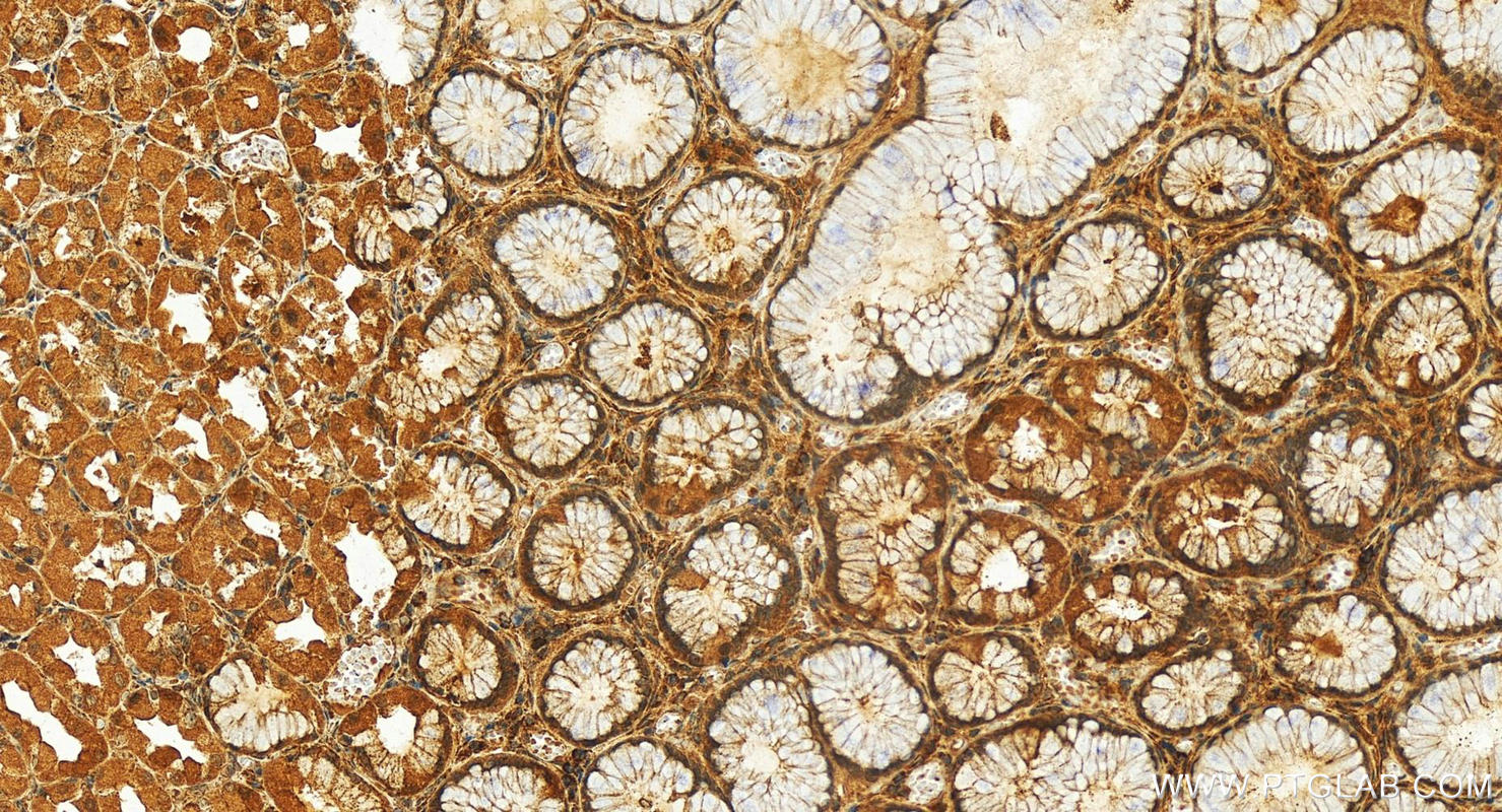 Immunohistochemistry (IHC) staining of human stomach tissue using FXN Polyclonal antibody (14147-1-AP)