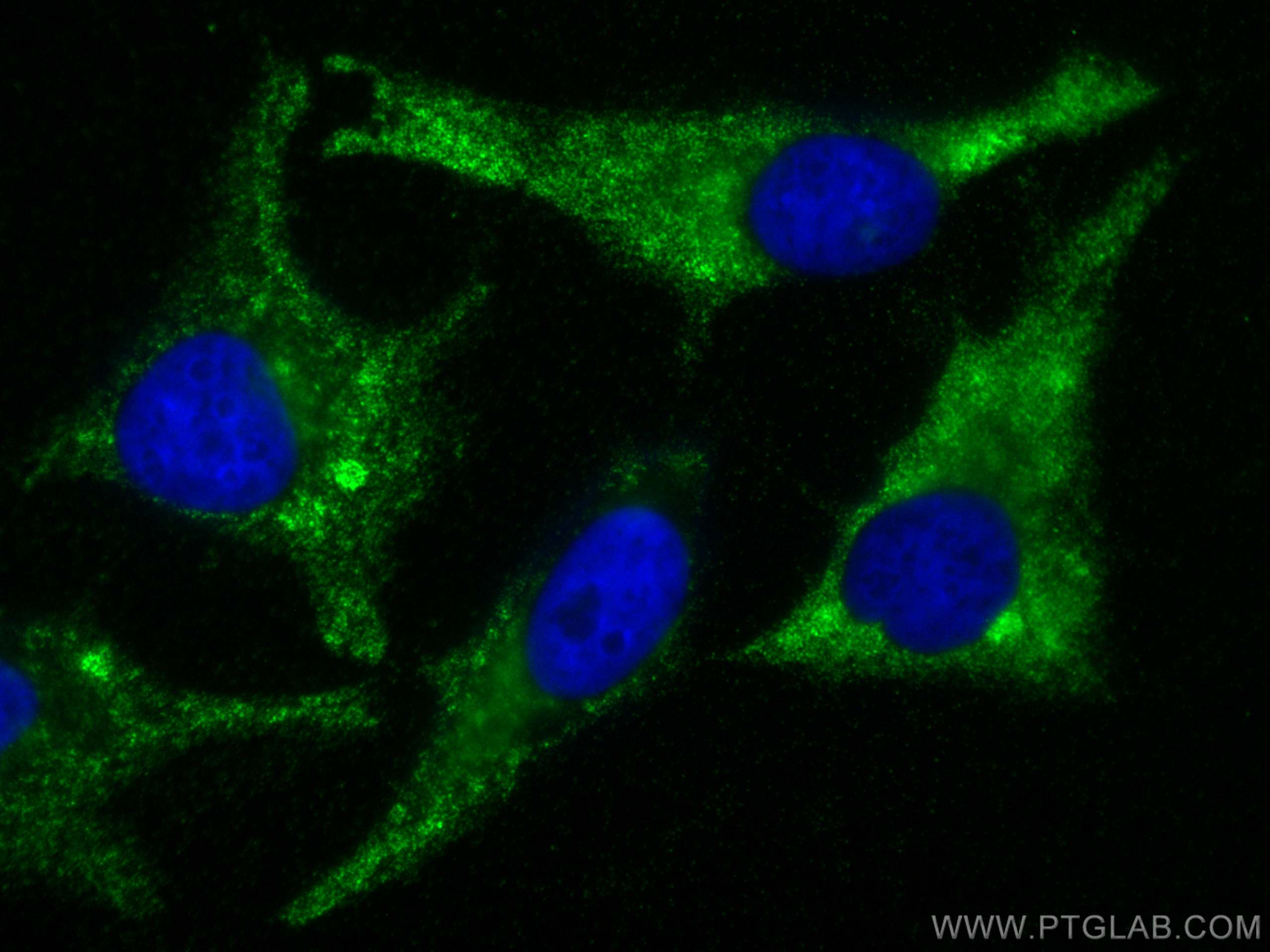 Immunofluorescence (IF) / fluorescent staining of HeLa cells using FXR1 Polyclonal antibody (13194-1-AP)