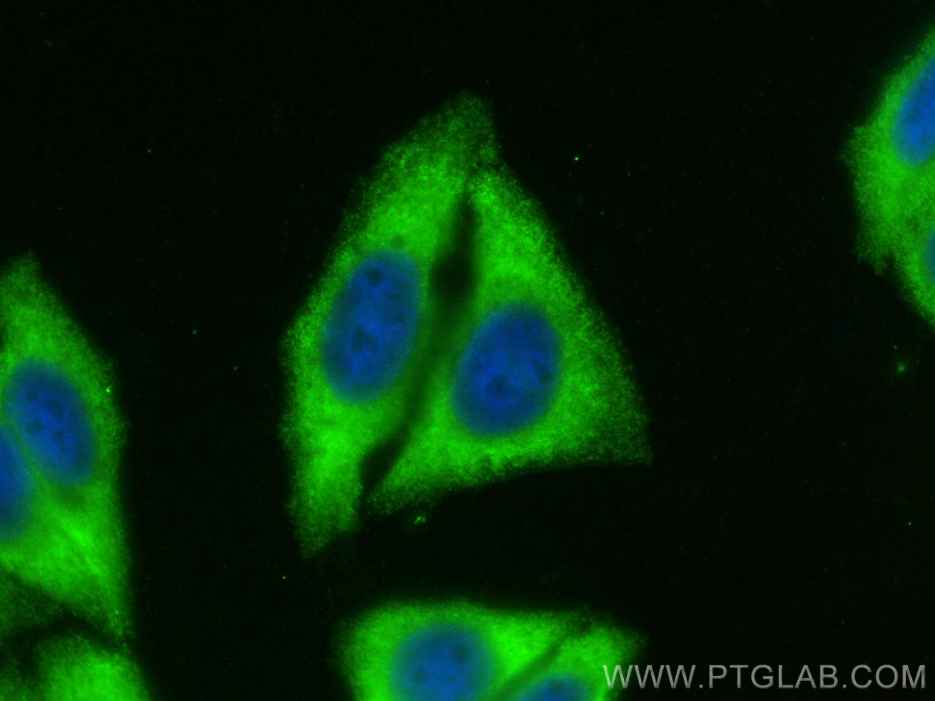 Immunofluorescence (IF) / fluorescent staining of HepG2 cells using FXR2 Polyclonal antibody (12552-1-AP)