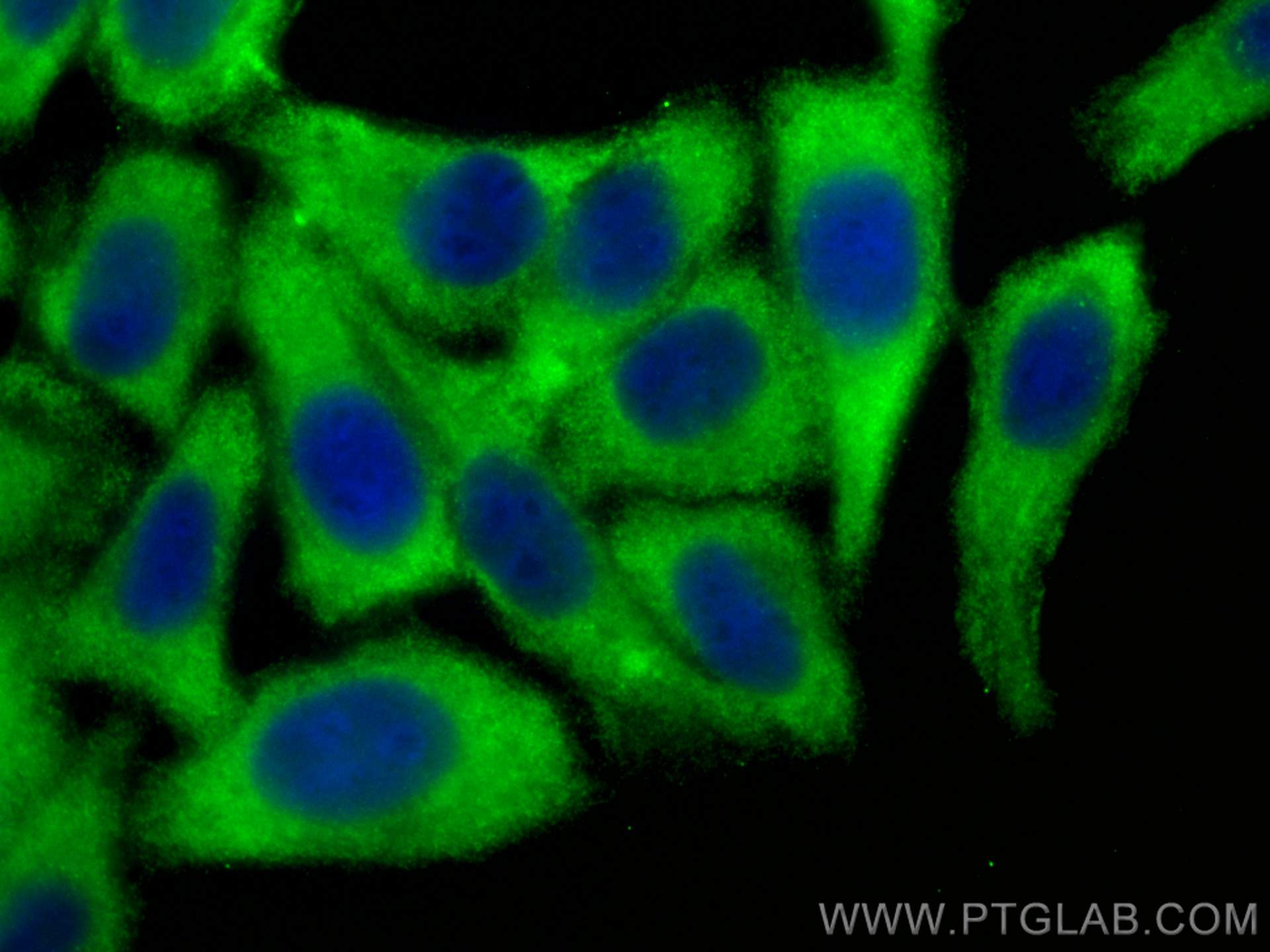 Immunofluorescence (IF) / fluorescent staining of HepG2 cells using FXR2 Polyclonal antibody (12552-1-AP)