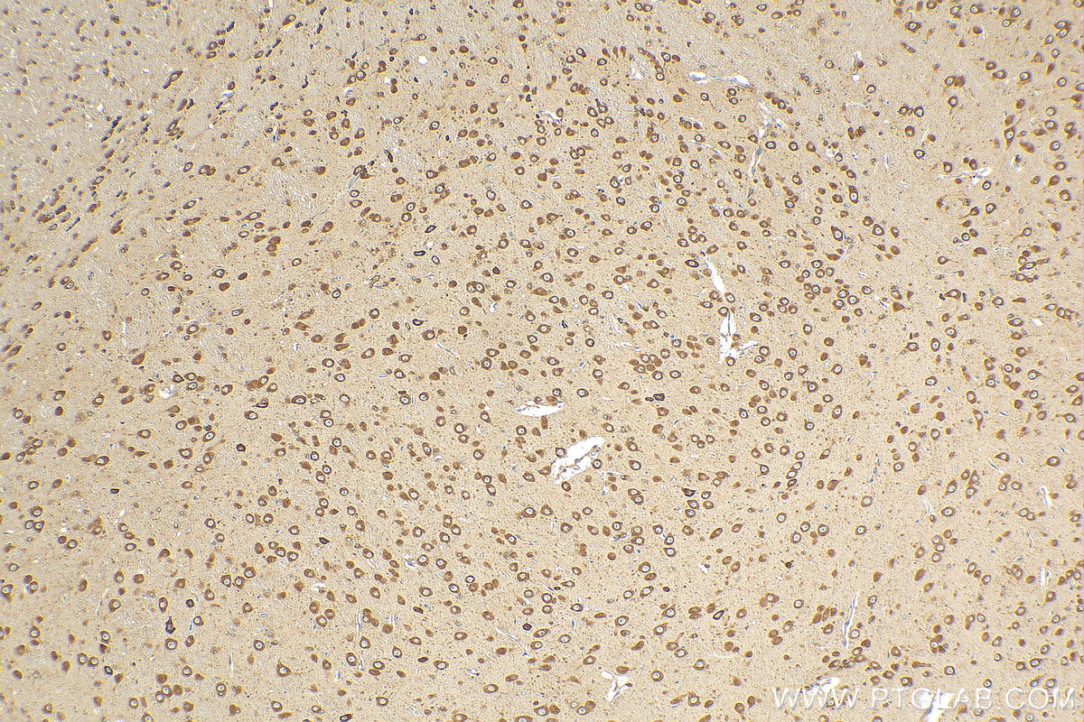 Immunohistochemistry (IHC) staining of mouse brain tissue using FXR2 Polyclonal antibody (12552-1-AP)