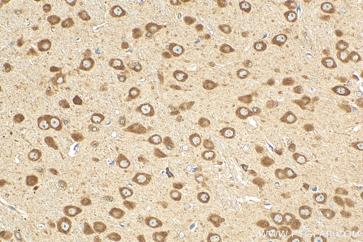 Immunohistochemistry (IHC) staining of mouse brain tissue using FXR2 Polyclonal antibody (12552-1-AP)