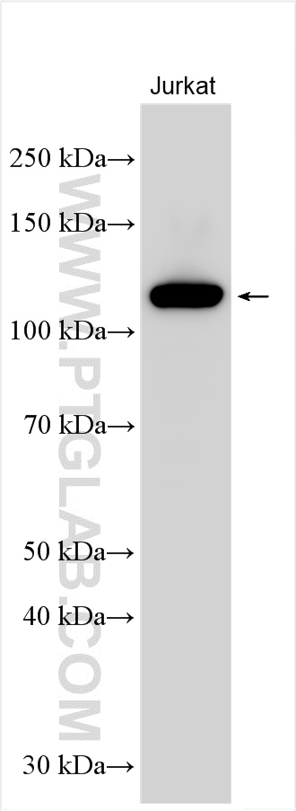 Western Blot (WB) analysis of various lysates using FYB Polyclonal antibody (31553-1-AP)