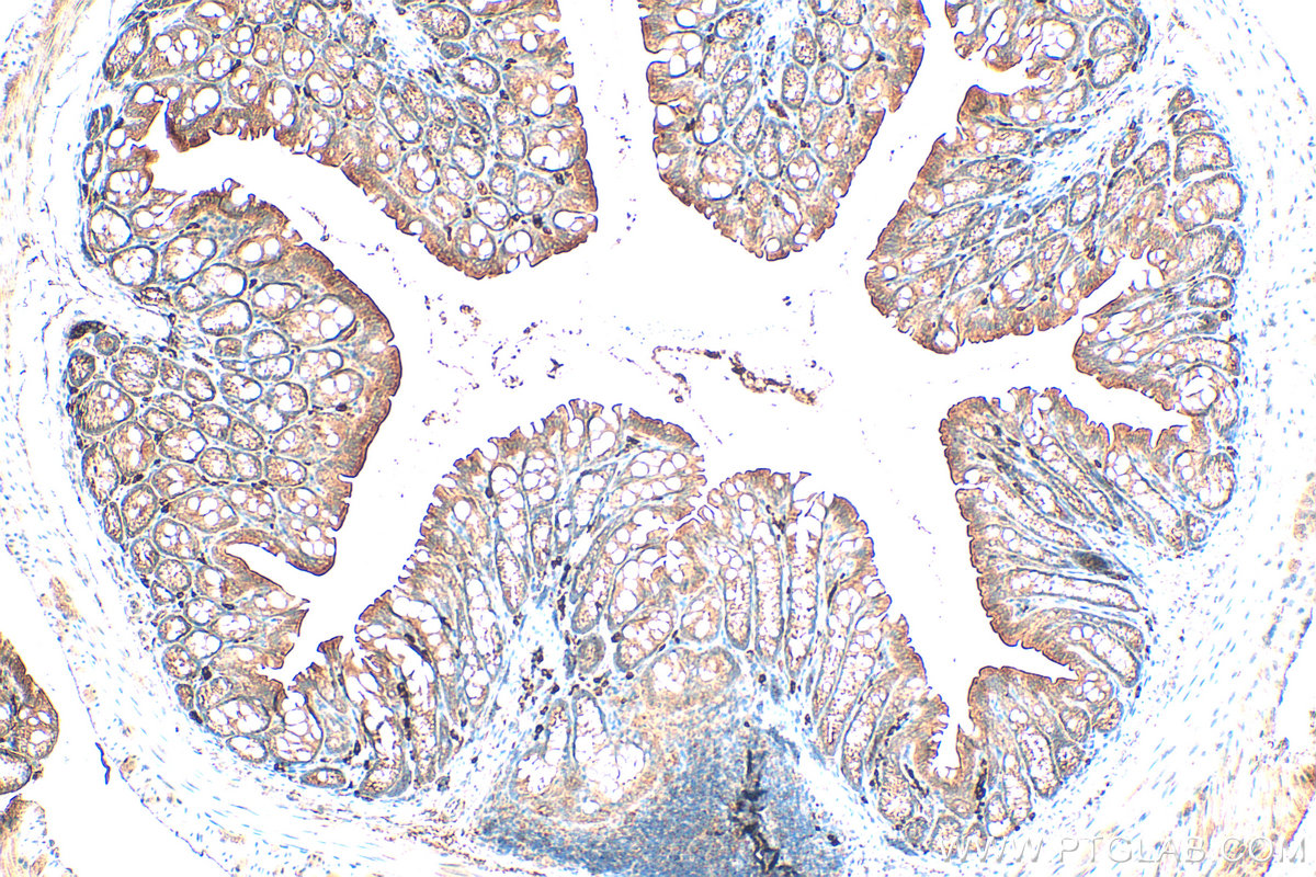 Immunohistochemistry (IHC) staining of mouse colon tissue using Frizzled 2 Polyclonal antibody (24272-1-AP)