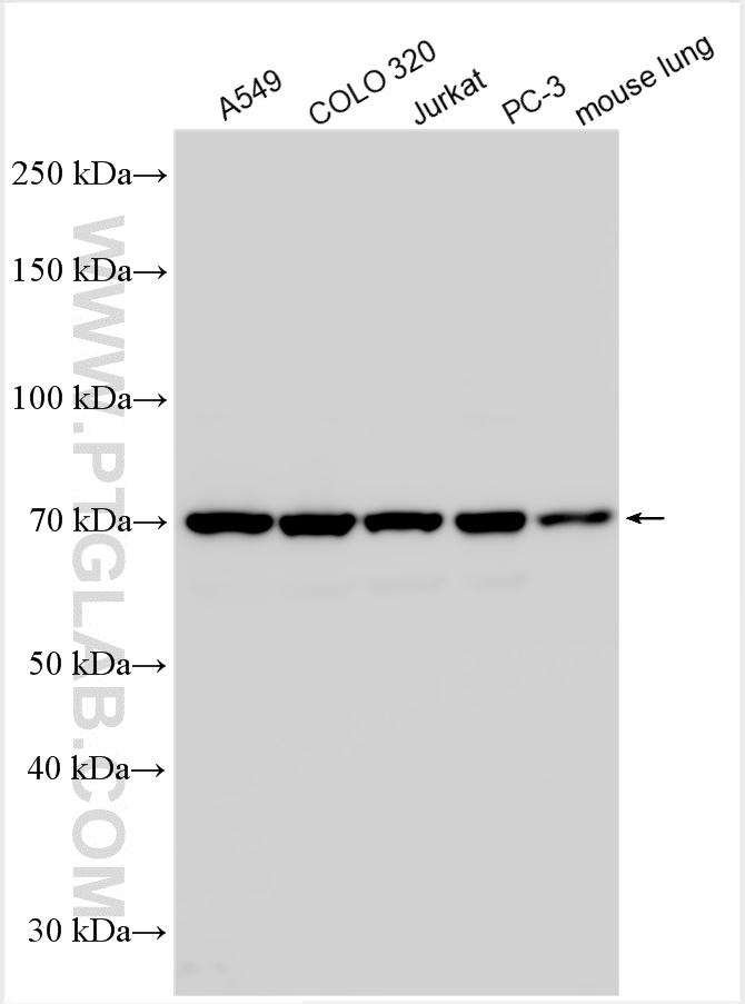 Western Blot (WB) analysis of various lysates using Frizzled 5 Polyclonal antibody (21519-1-AP)