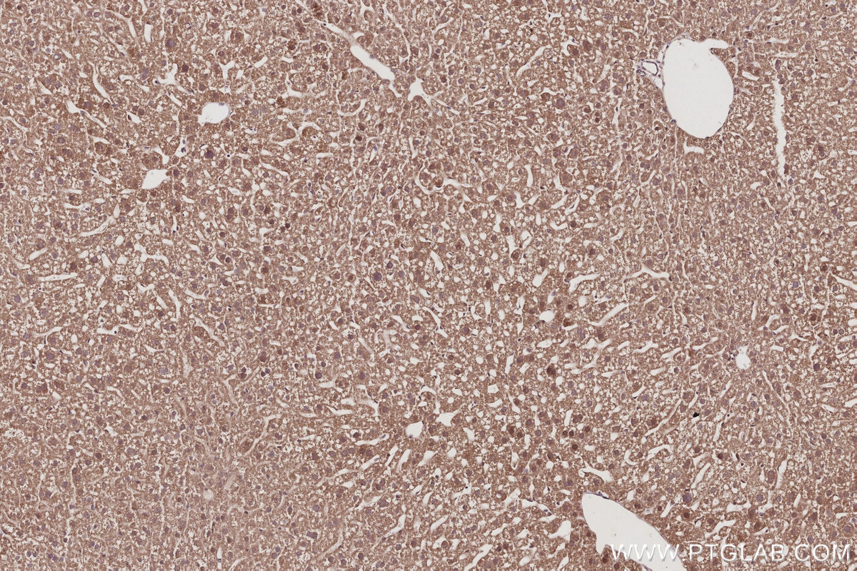 Immunohistochemistry (IHC) staining of mouse liver tissue using FZR1/Cdh1 Polyclonal antibody (16368-1-AP)